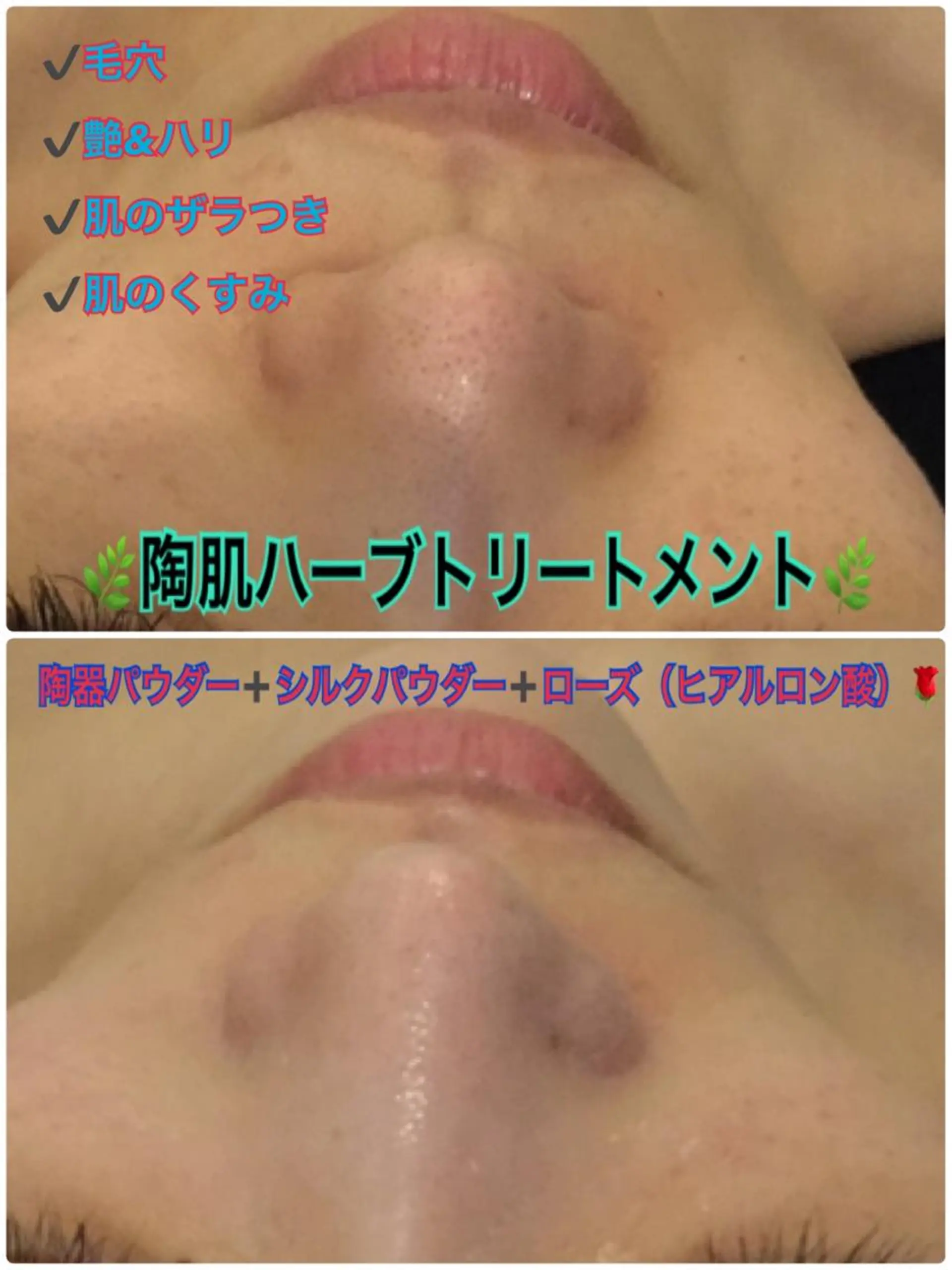 エステ 【リベルハーブピーリング認定店】敏感肌・美白脱毛専門店Dione立川店所属・Dione 立川店のエステ・リラクイメージ