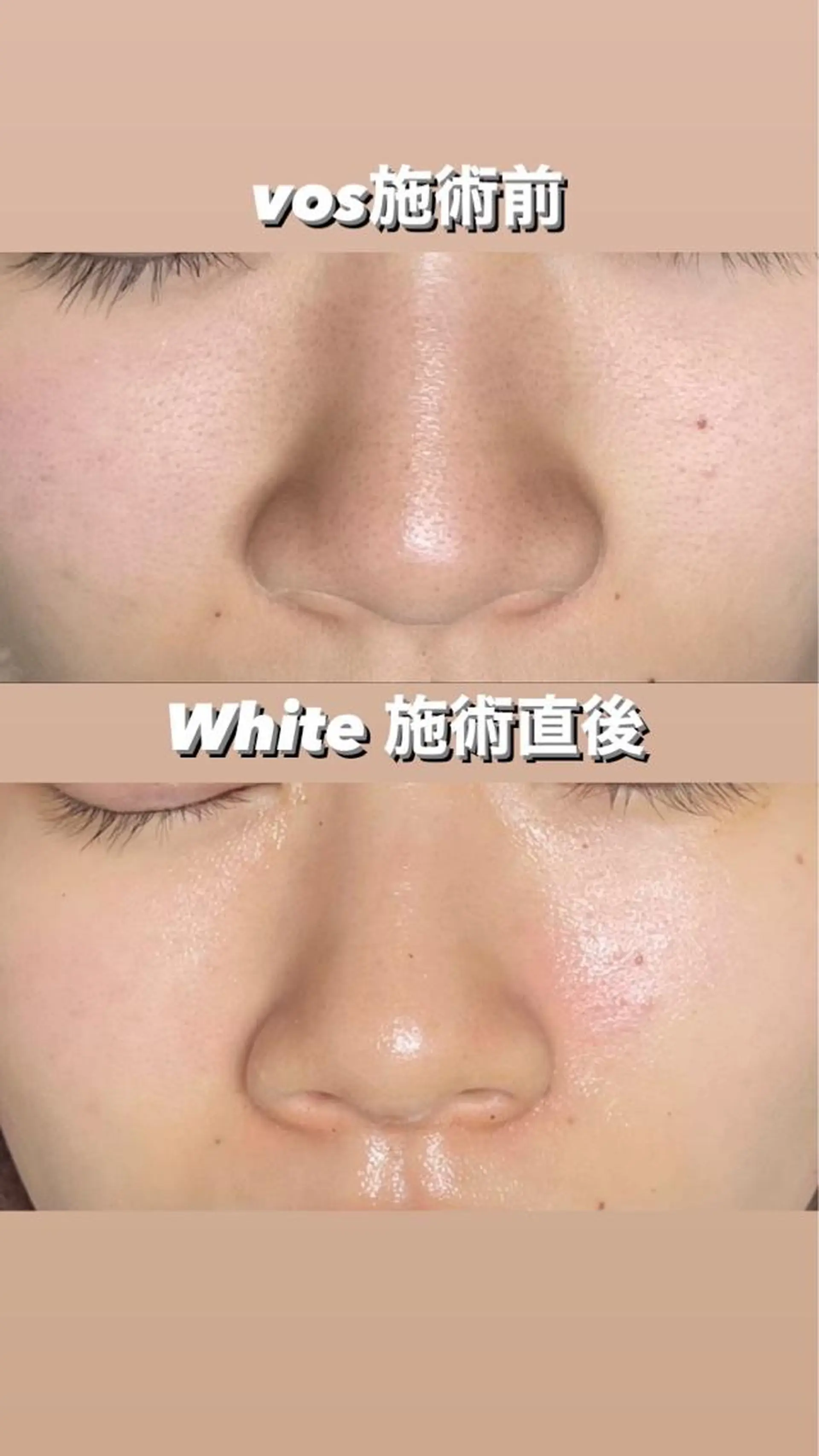 代表 MOMOのエステ・リラクイメージ