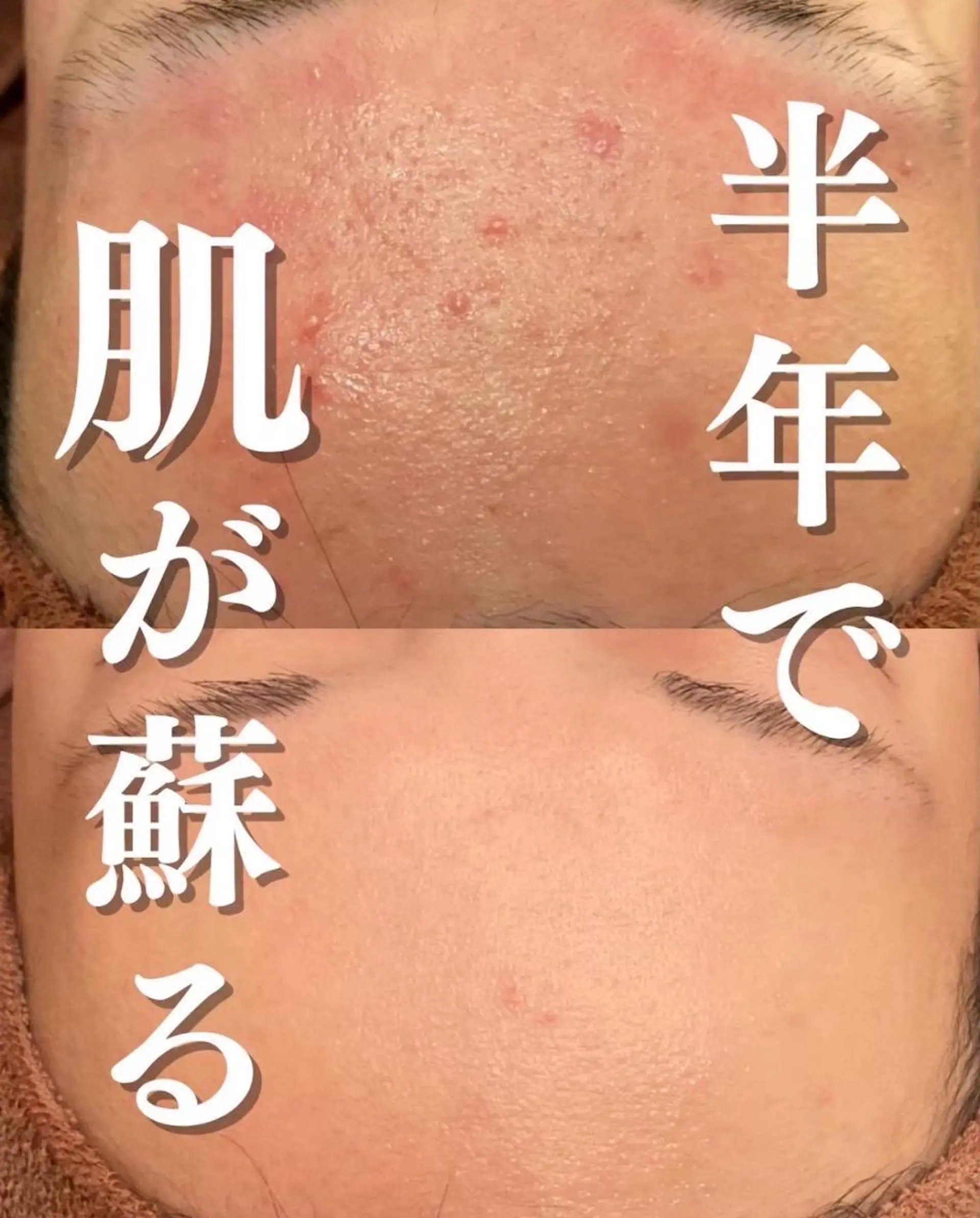 夏までに肌荒れ卒業 するサロン🌻のエステ・リラクイメージ