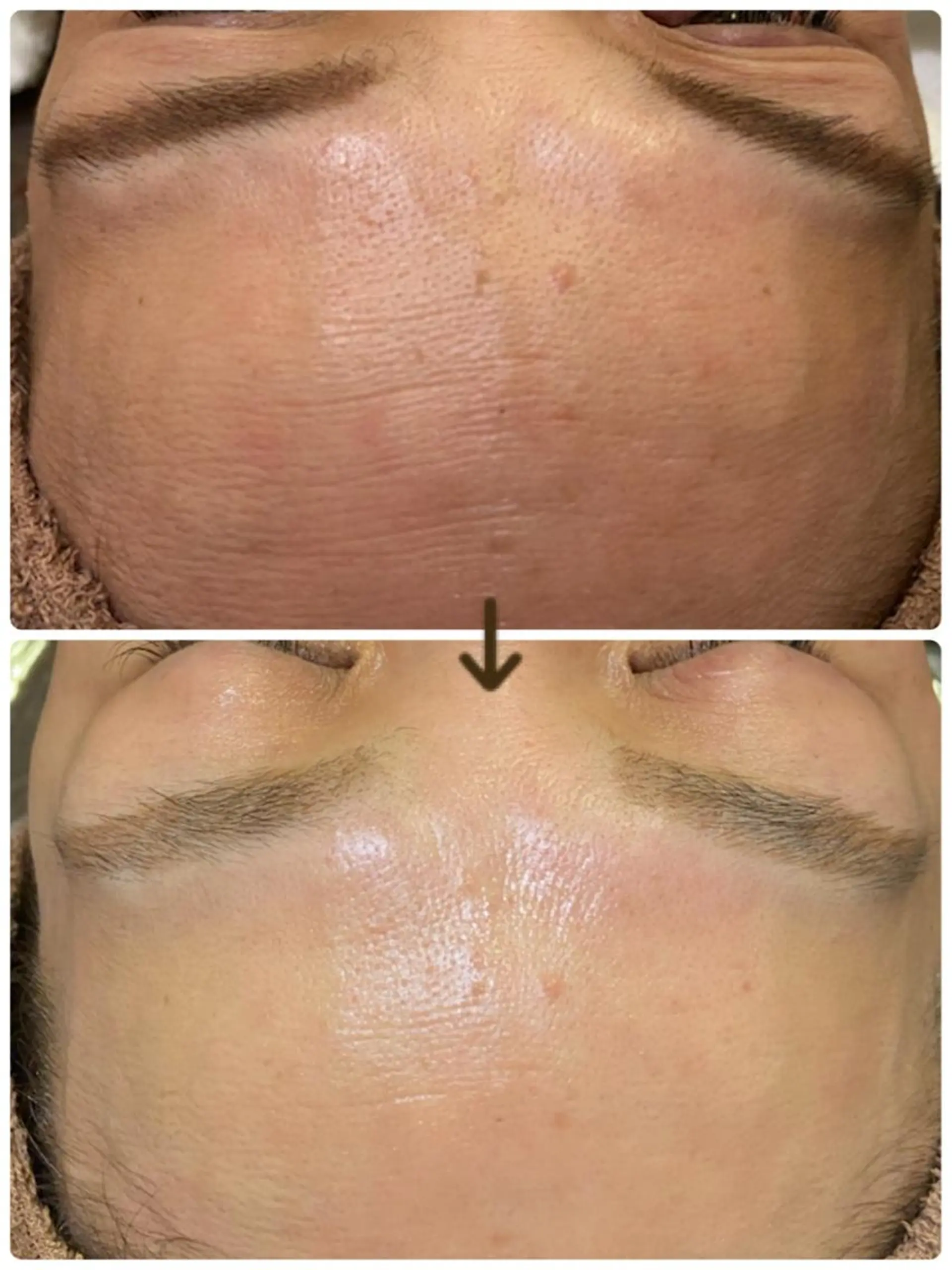 aroma  YURARI所属・韓国艶美人// 毛穴ケア🌹のエステ・リラクイメージ