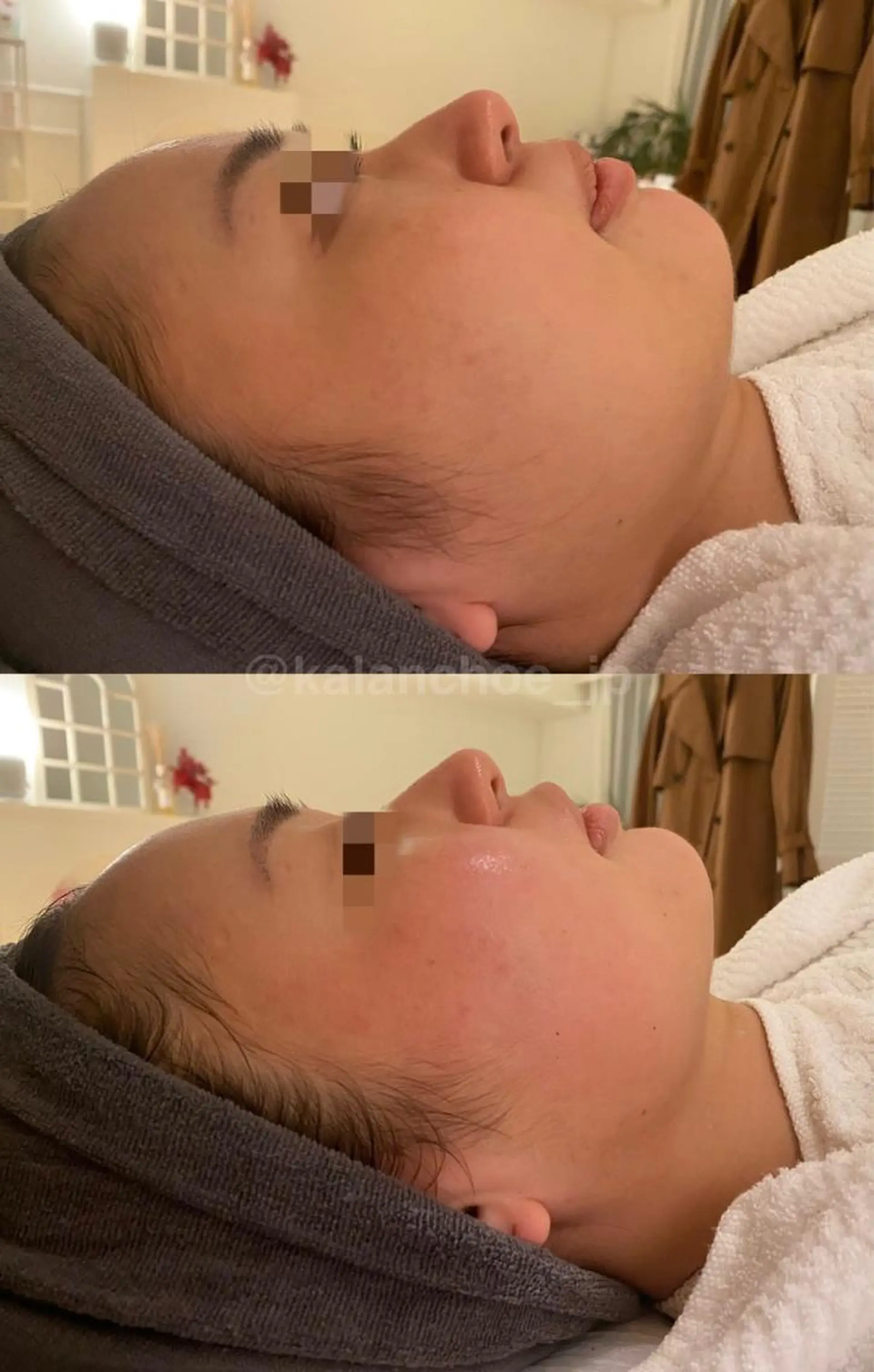 エステ 肌質改善 KALANCHOEのエステ・リラクイメージ