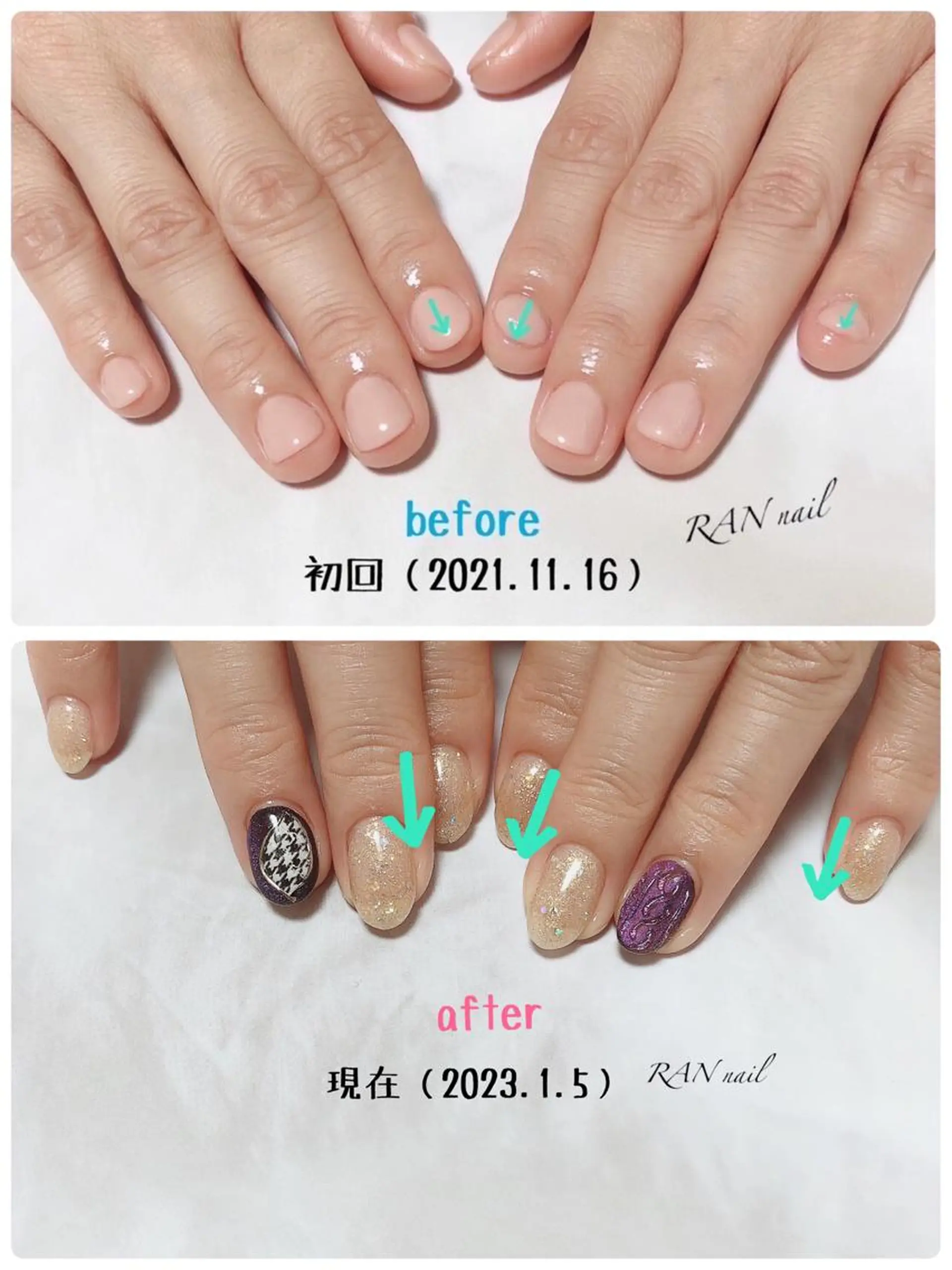 ネイル クリアネイル 成人式 フレンチネイル ジェルネイル ラメ(グリッター) ハンドネイル フットネイル RAN nail 〜ランネイル〜所属・RAN nailのネイルデザイン