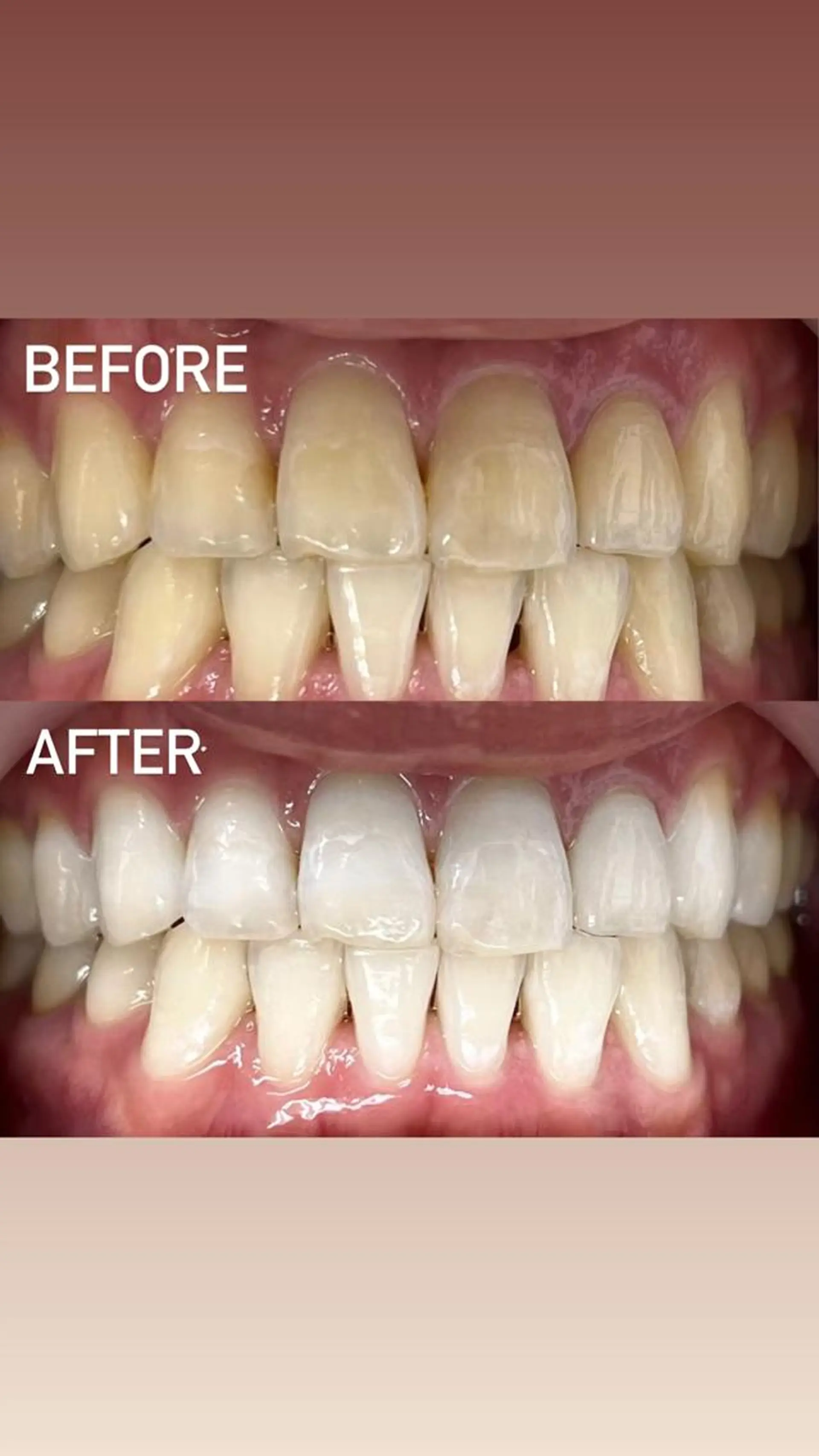 その他 LBSホワイトニング 銀座店💎店長浦和のその他イメージ