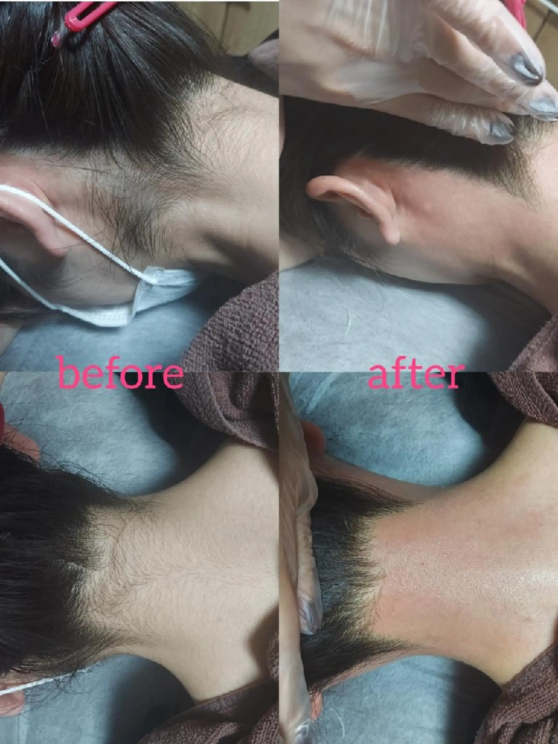 脱毛サロンLULA 恵比寿店濱野のエステ・リラクイメージ