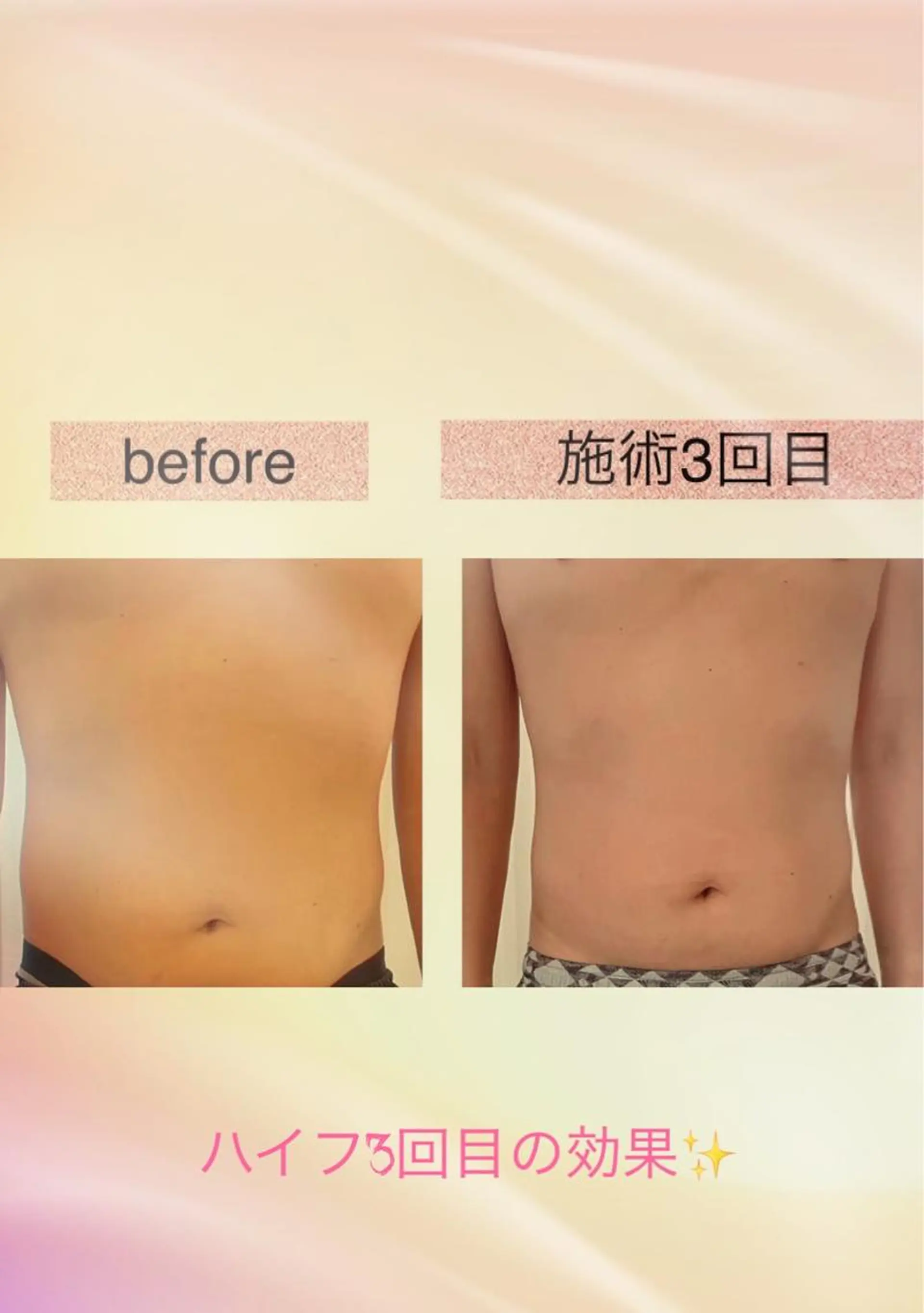 rasera所属・rasera コラボ予約のネイルデザイン