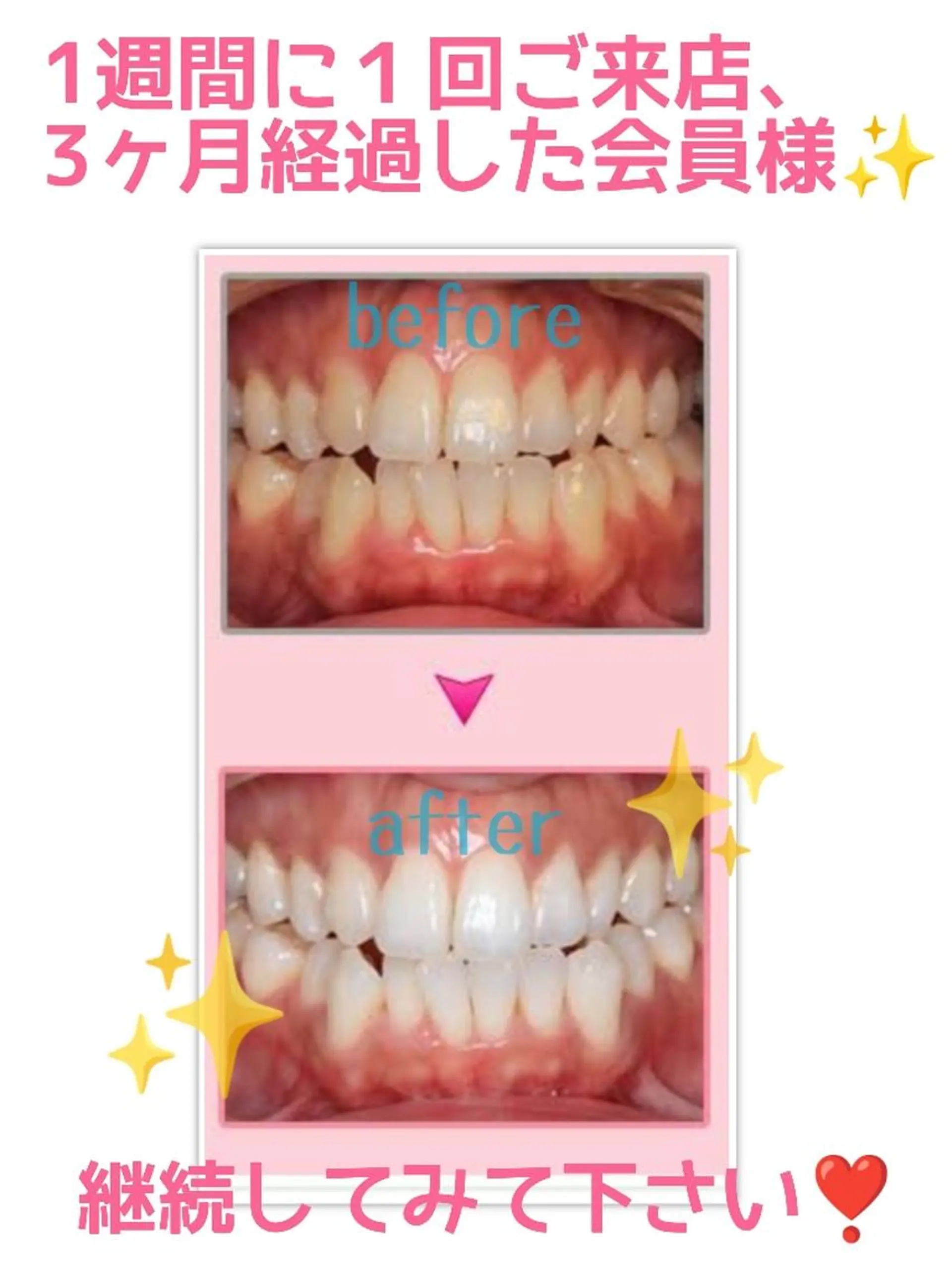 その他 セルフホワイトニング エクシア大宮東口店所属・セルフホワイトニング エクシア大宮東口店のその他イメージ