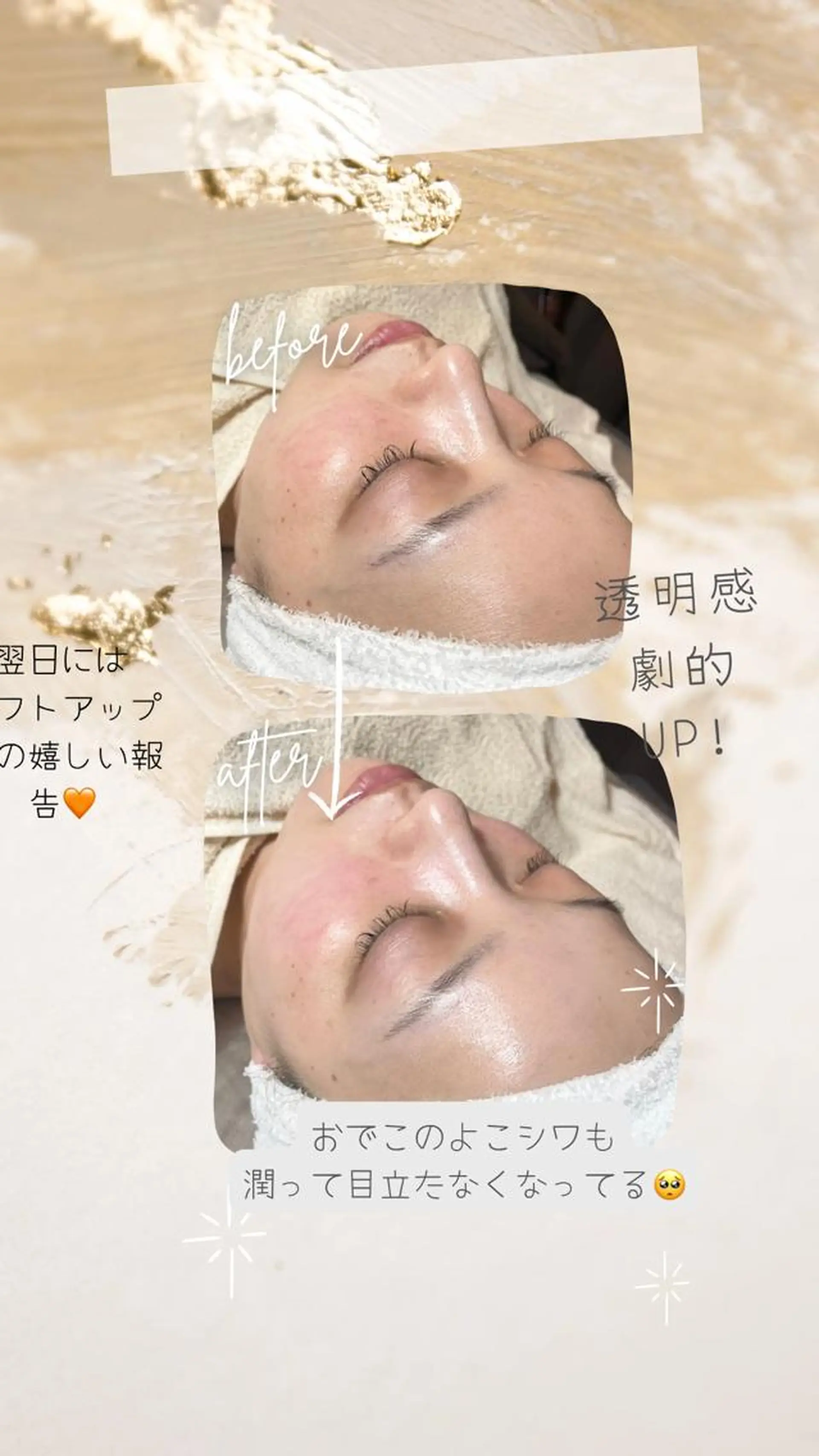 エステ リラク 痩身・フェイシャル/if  byOrabriller所属・if byOrab riller【ｲﾌ】のその他イメージ