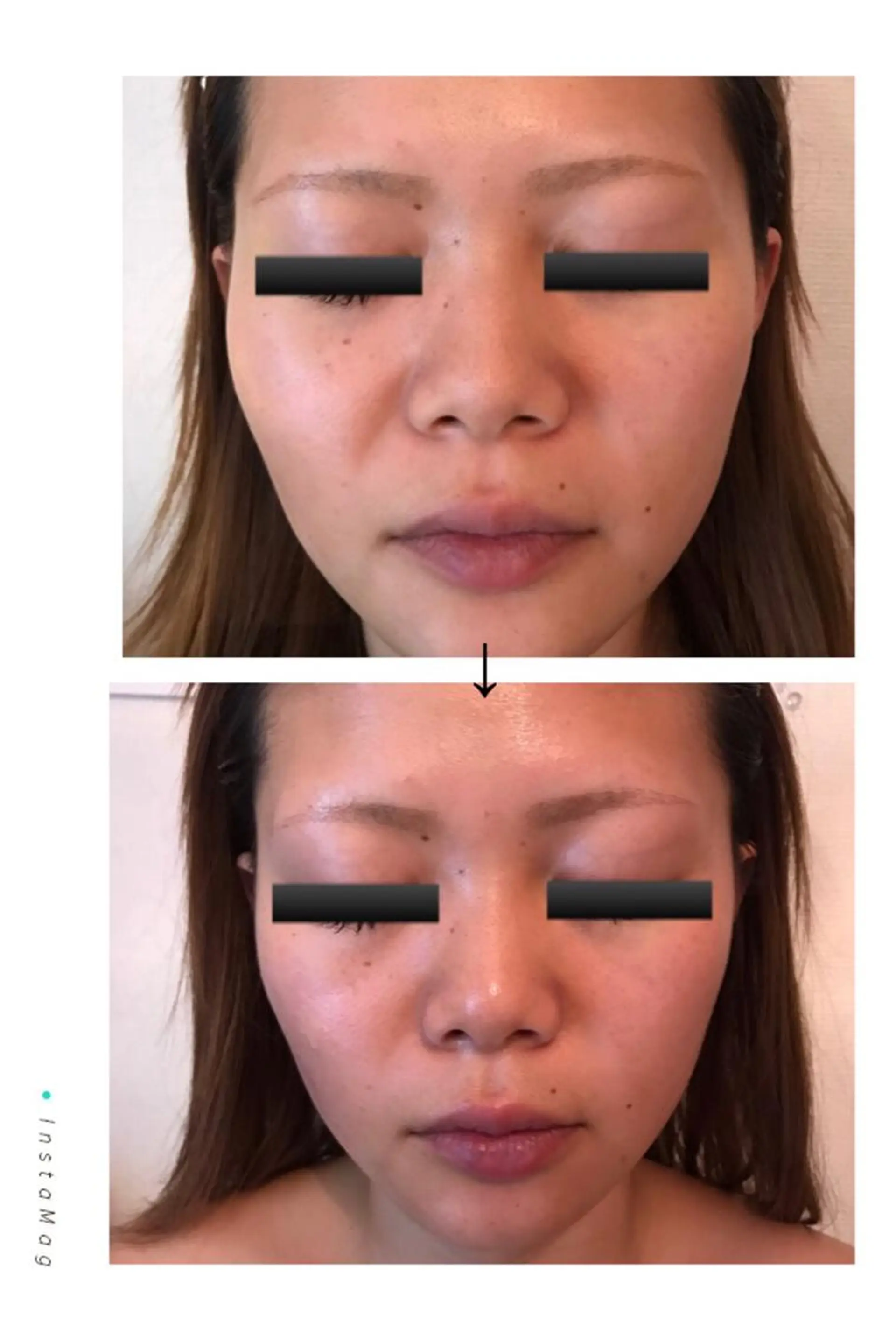 フェアリーローズ所属・fairyrose organicエステのエステ・リラクイメージ