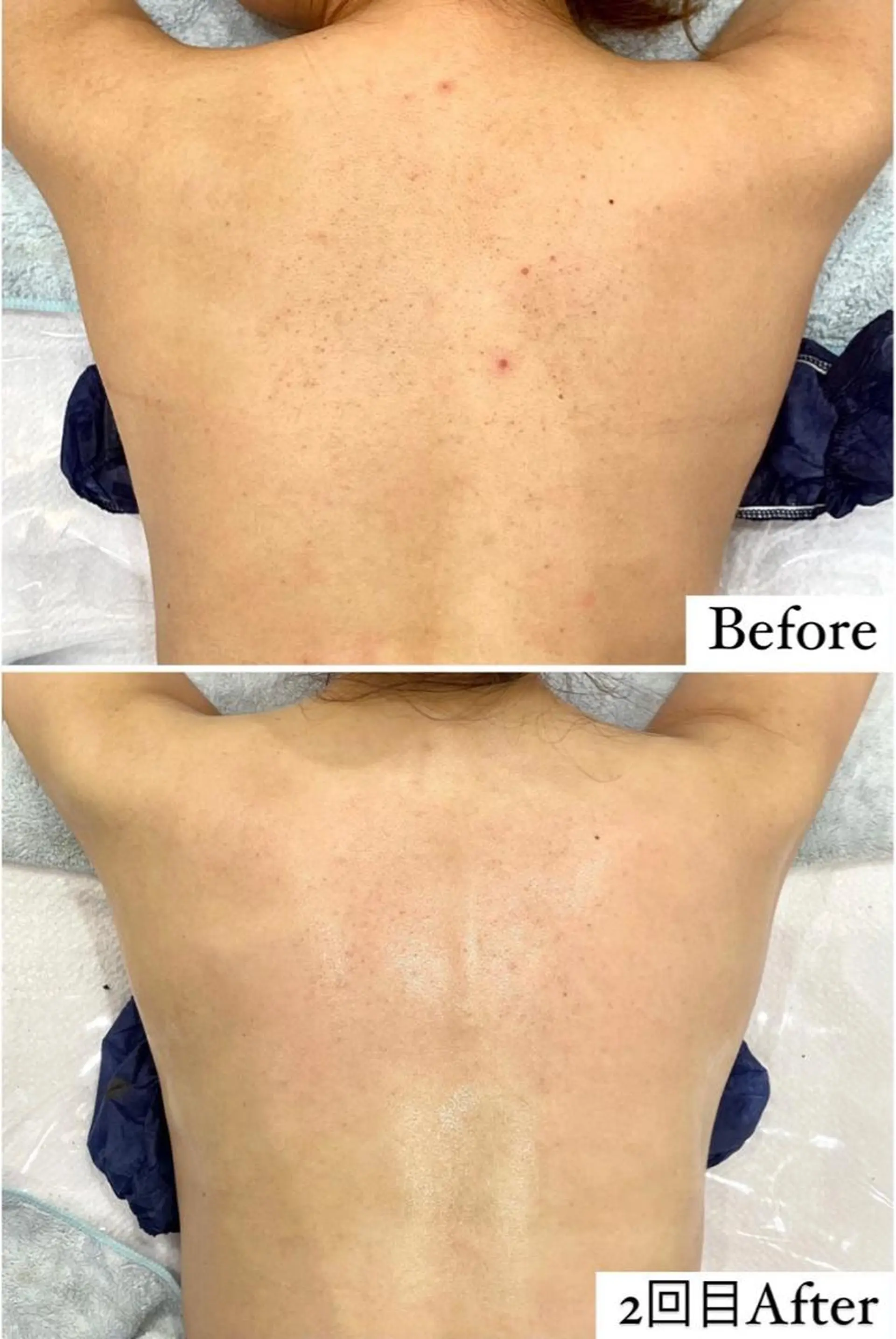 mignon /栄のエステ・リラクイメージ