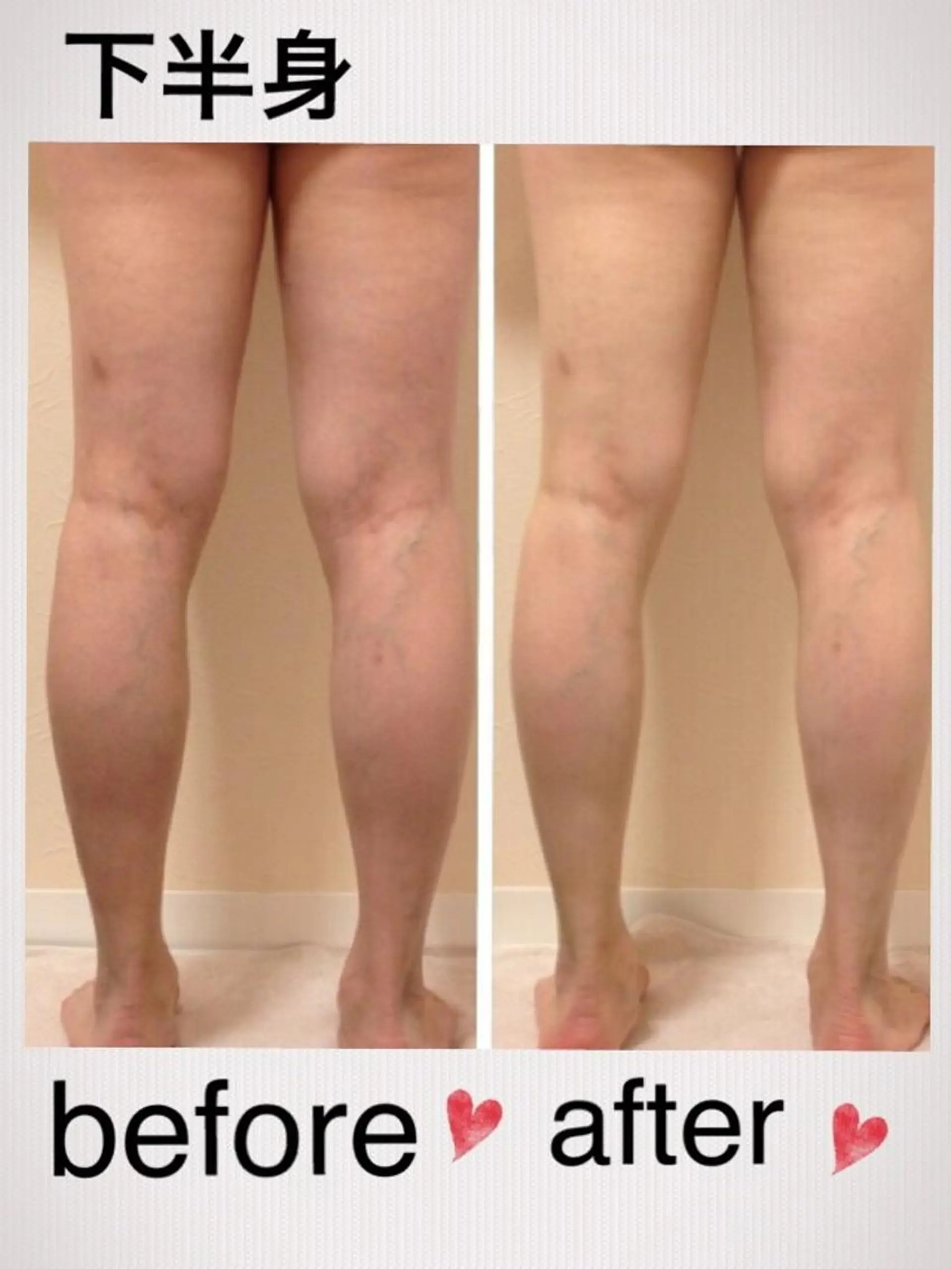 エステ リラク BACI STYLE夙川サロン所属・肌管理専門 BACI夙川サロンのエステ・リラクイメージ