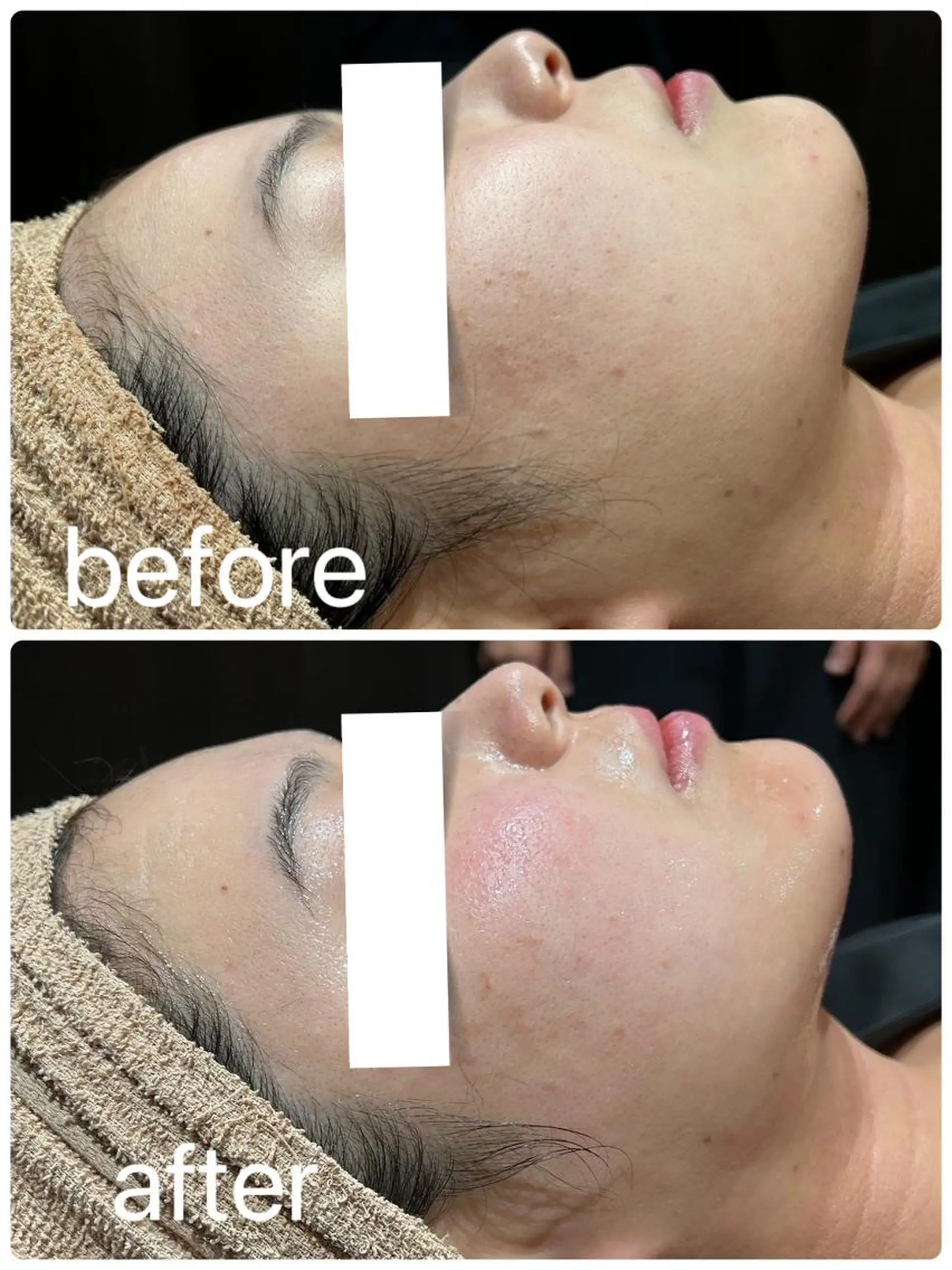 👑Linolaby RAYVIS👑💗のエステ・リラクイメージ