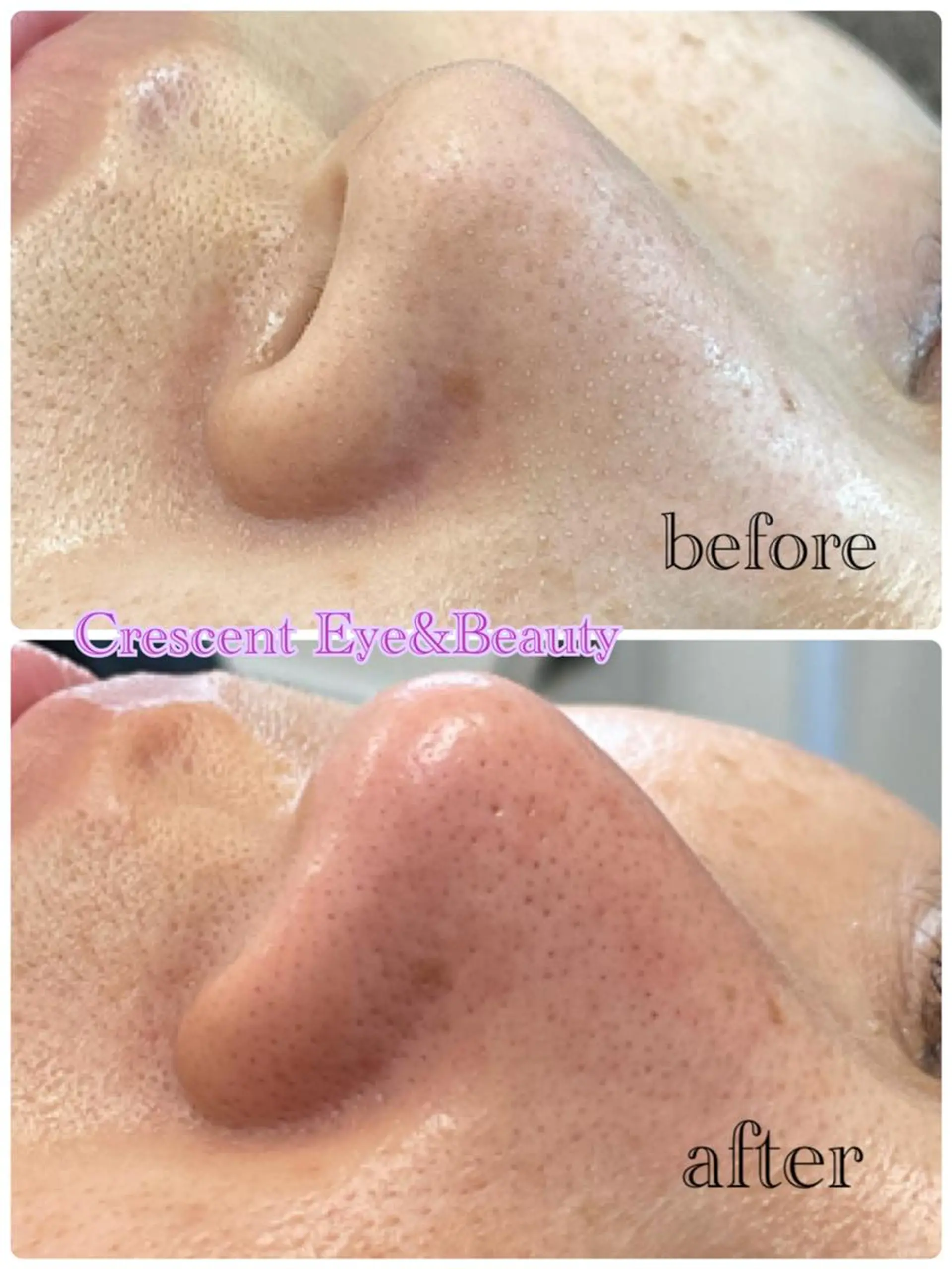 Crescent Beautyのエステ・リラクイメージ