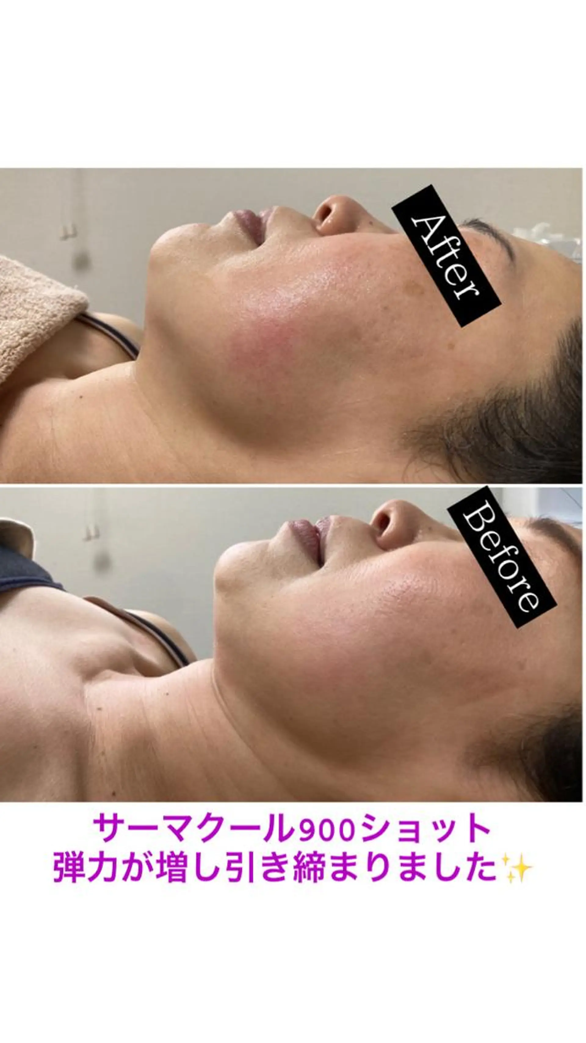 ミディアム カラー パーマ ヘアアレンジ メンズ キッズ ネイル マツエク・マツパ アイブロウ エステ 毛穴,ニキビ跡 改善総合サロンのエステ・リラクイメージ