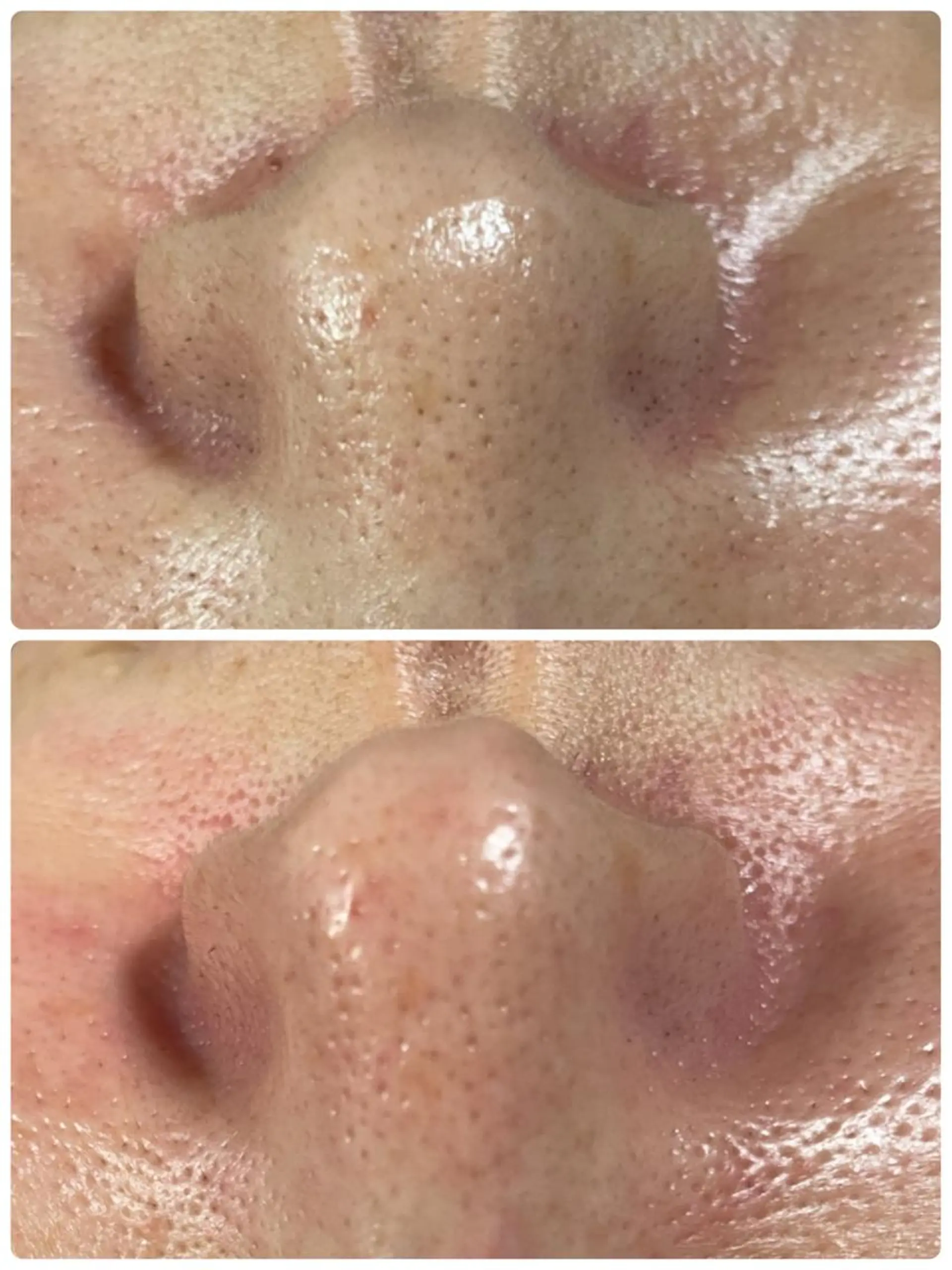 エステ／ネイル/脱毛 R.Msalonのネイルデザイン