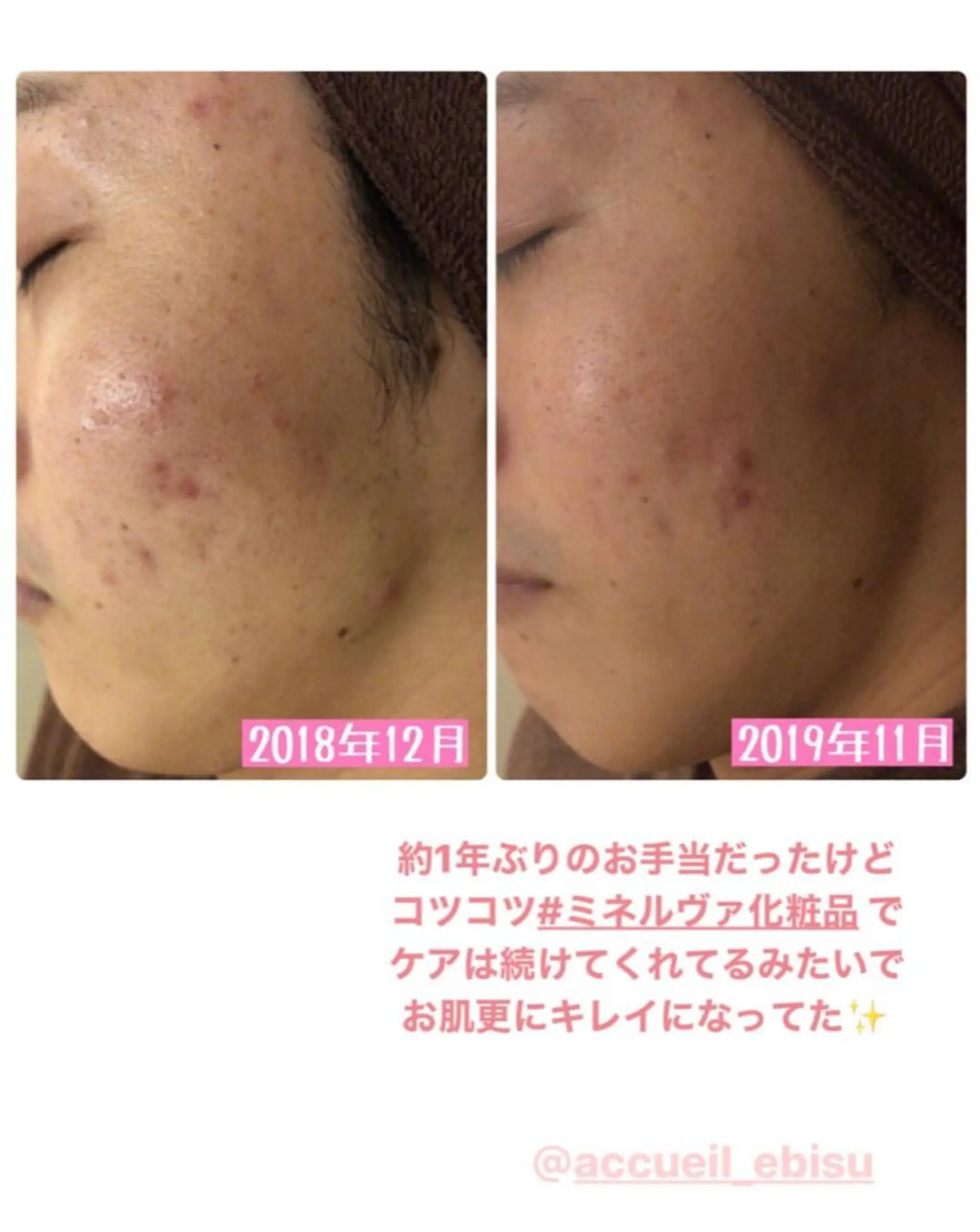 ミディアム カラー パーマ ヘアアレンジ メンズ キッズ ネイル マツエク・マツパ エステ リラク ニキビ・肌質改善専門 ♡人生が変わるサロンのエステ・リラクイメージ