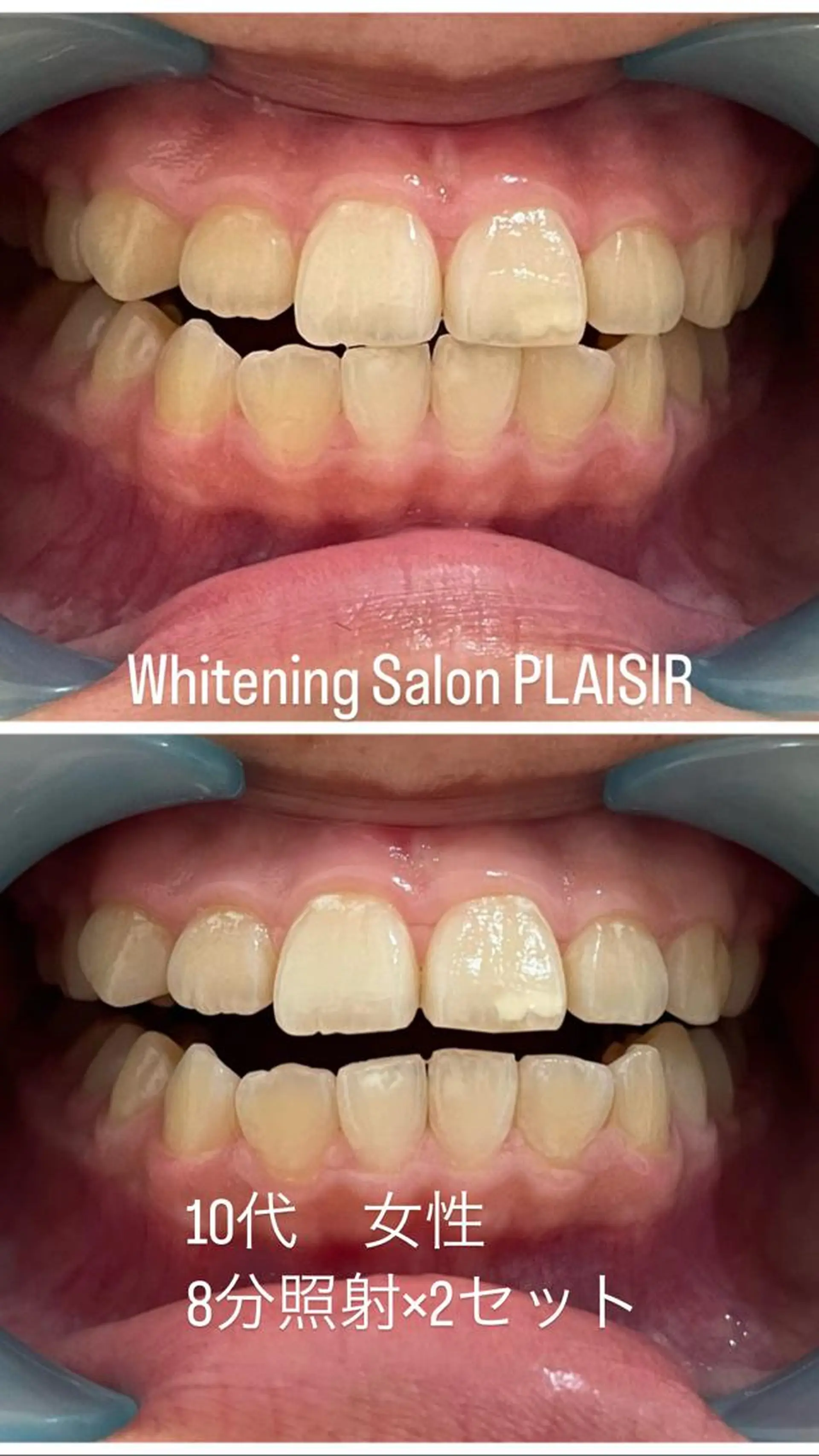 その他 ホワイトニングサロン プレジールのエステ・リラクイメージ