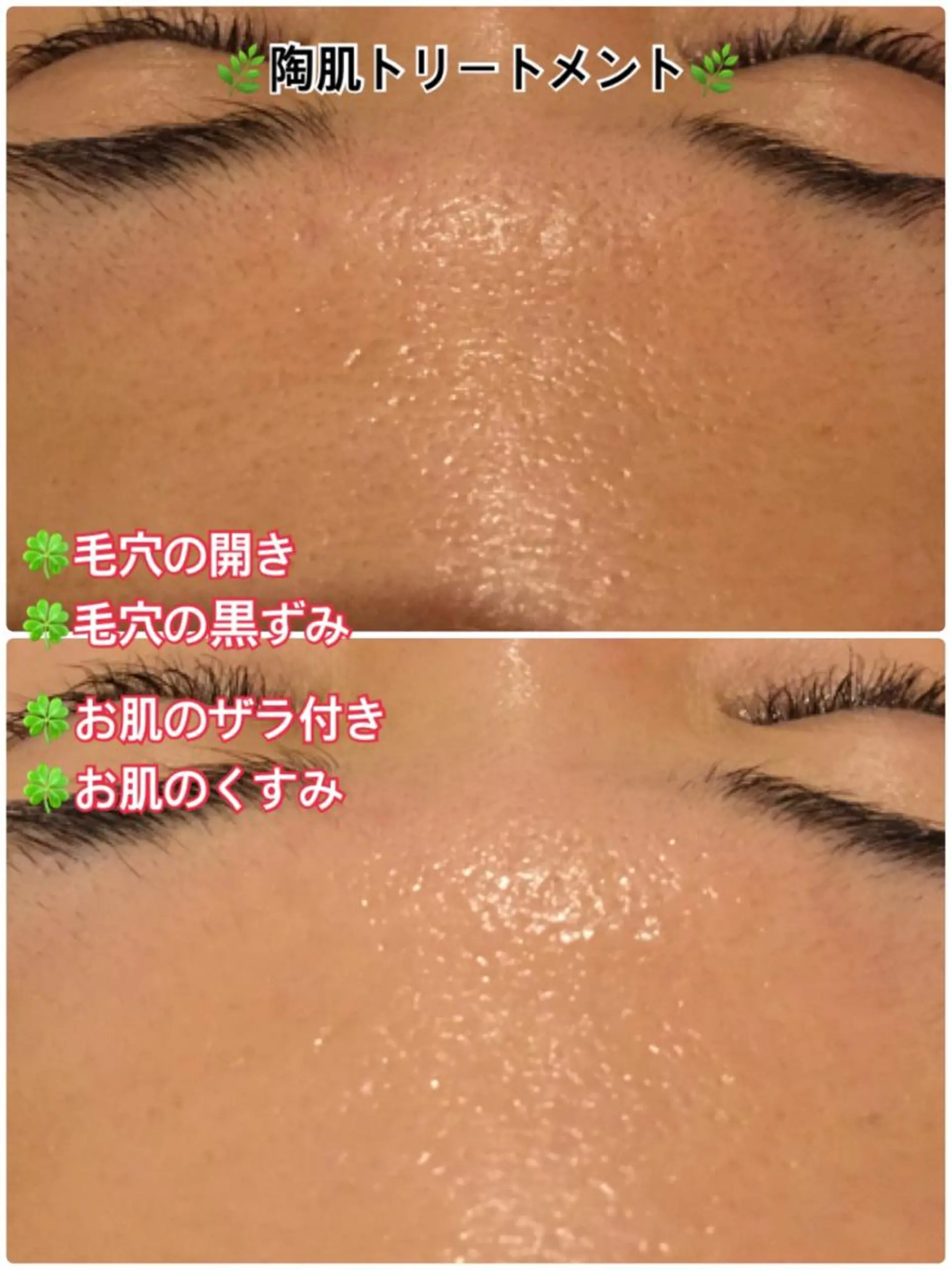 エステ 【リベルハーブピーリング認定店】敏感肌・美白脱毛専門店Dione立川店所属・Dione 立川店のエステ・リラクイメージ