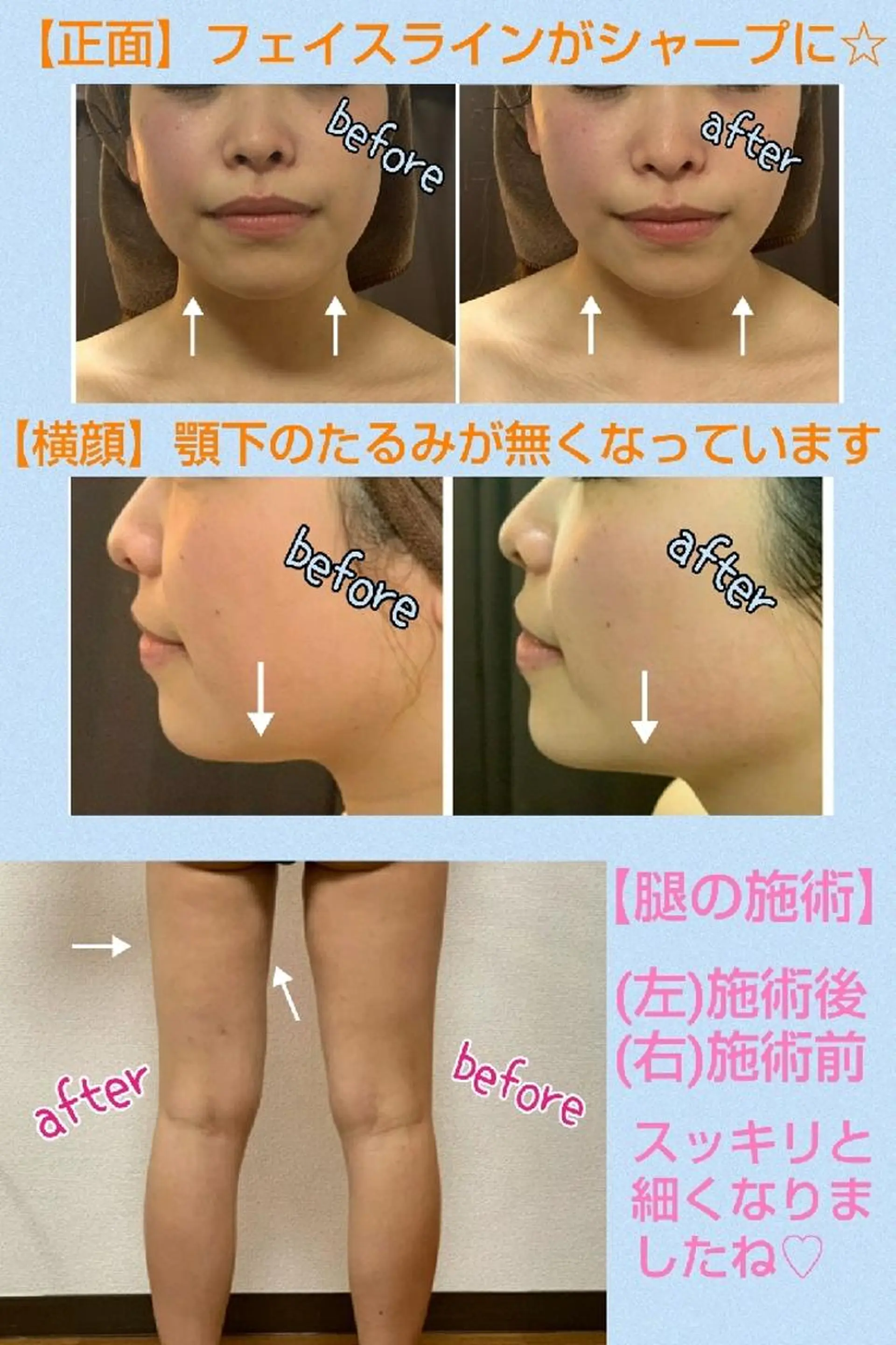 都度払いサロン BURIANのマツエク・マツパデザイン