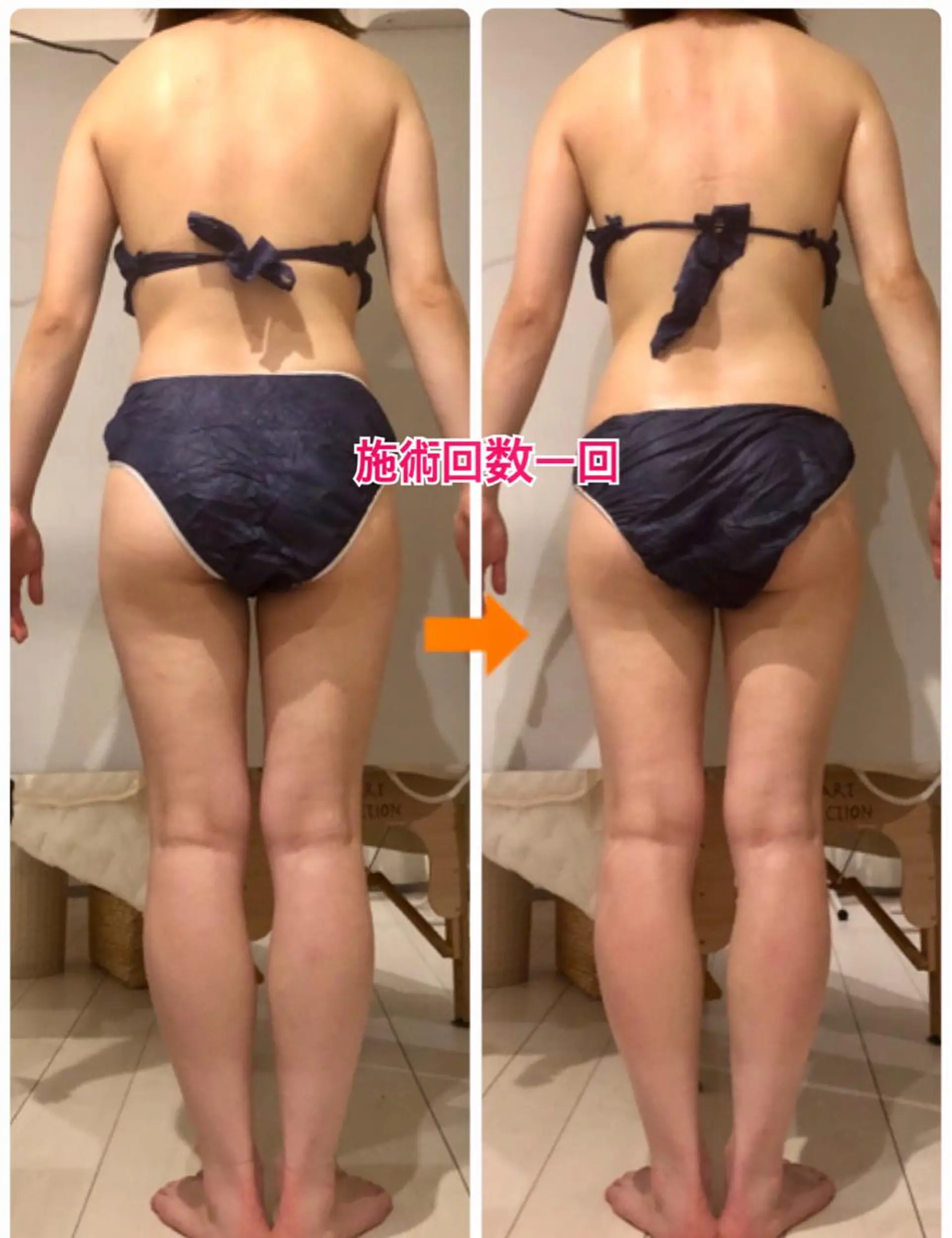 ロング カラー パーマ ヘアアレンジ メンズ キッズ ネイル マツエク・マツパ ‍痩身＆ボディ 結果出し🌟丹野のエステ・リラクイメージ