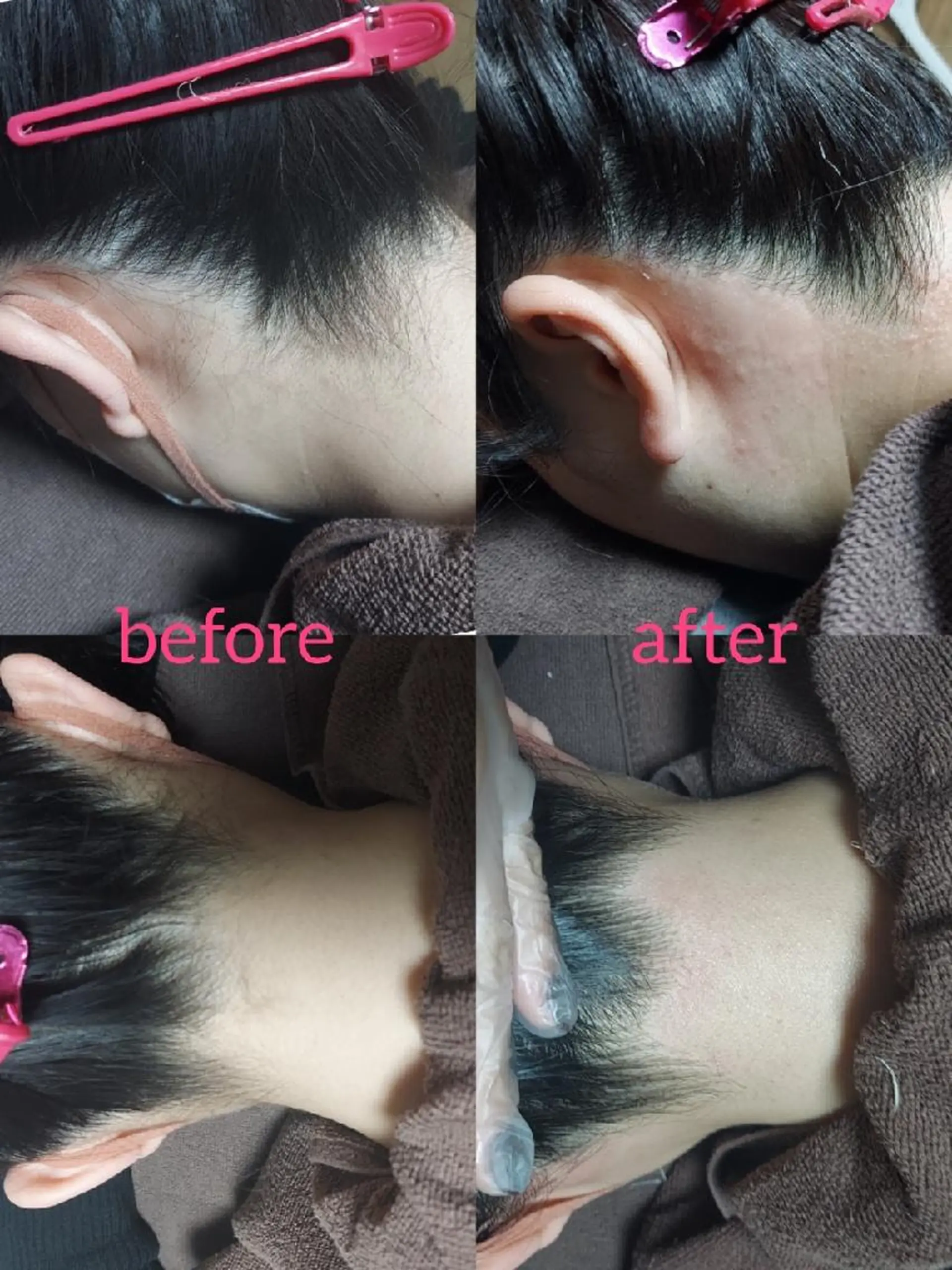 脱毛サロンLULA 恵比寿店濱野のエステ・リラクイメージ