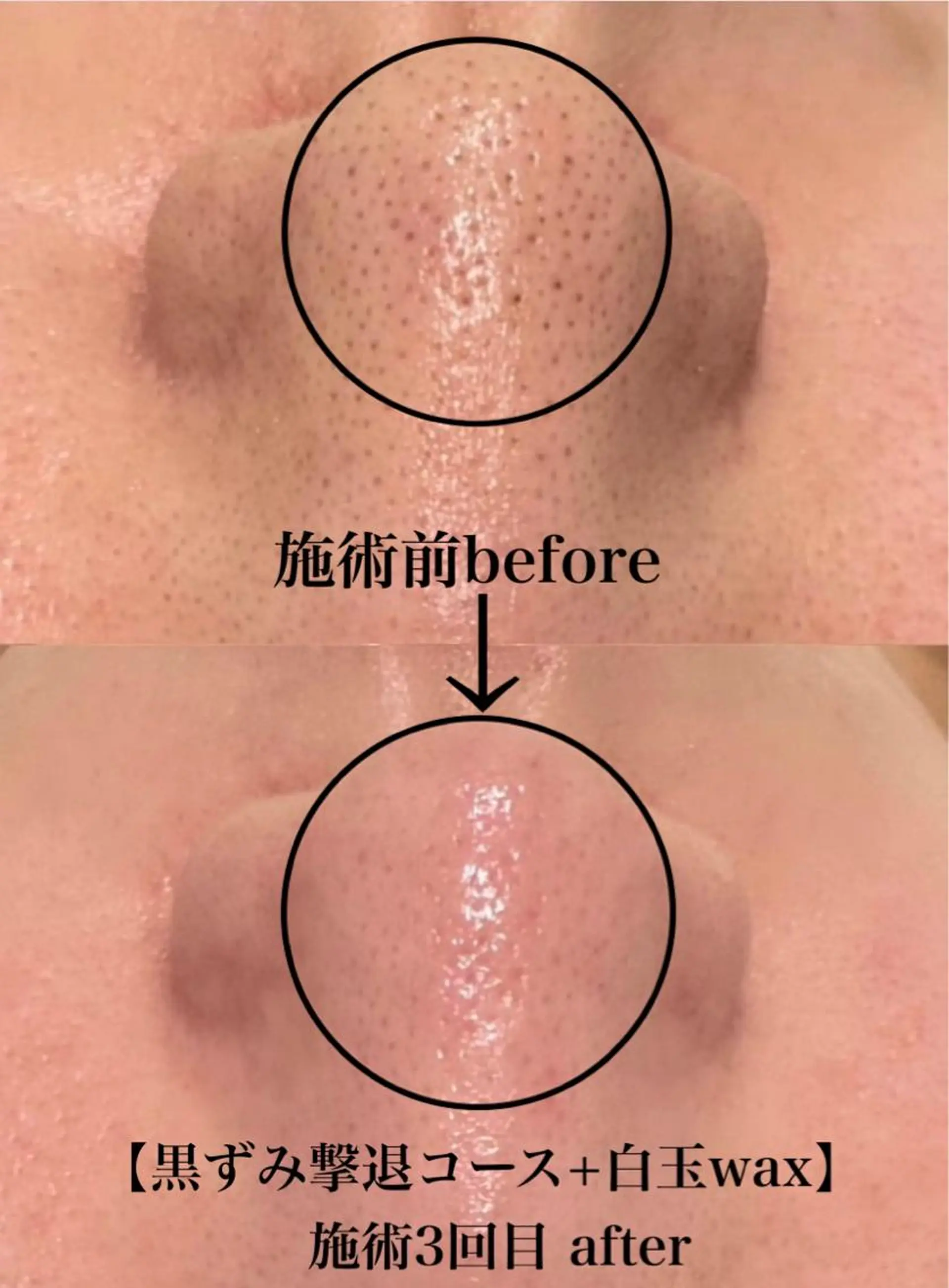 韓国肌管理 【毛穴専科】のエステ・リラクイメージ