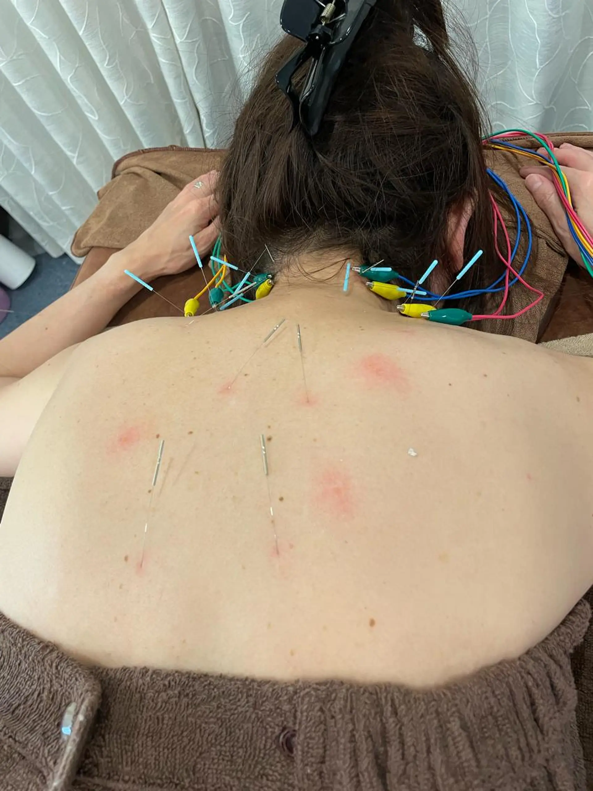 その他 美容鍼灸サロン mahoroba院長のエステ・リラクイメージ