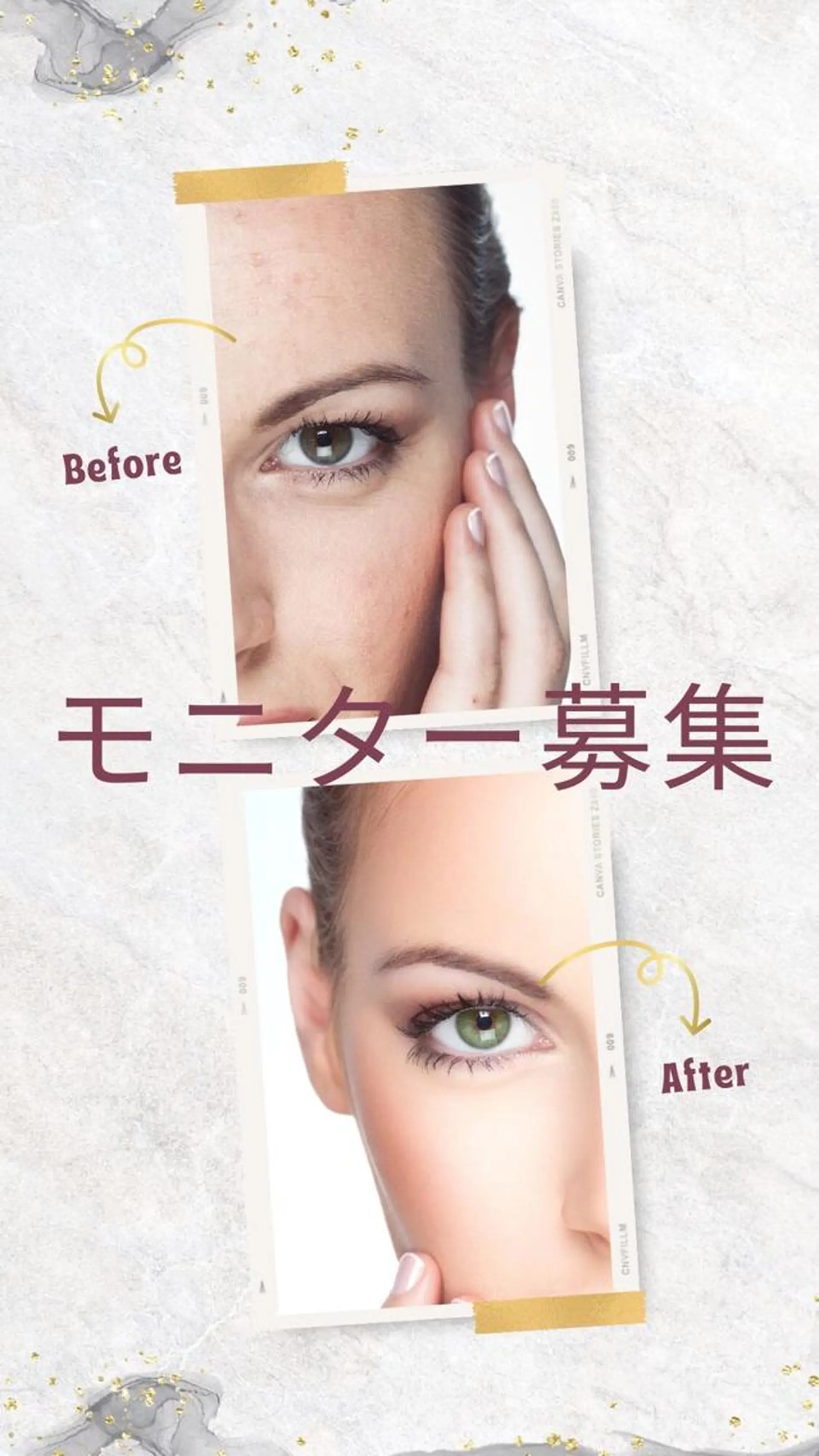 頭蓋骨小顔矯正 ハーブピーリングのエステ・リラクイメージ