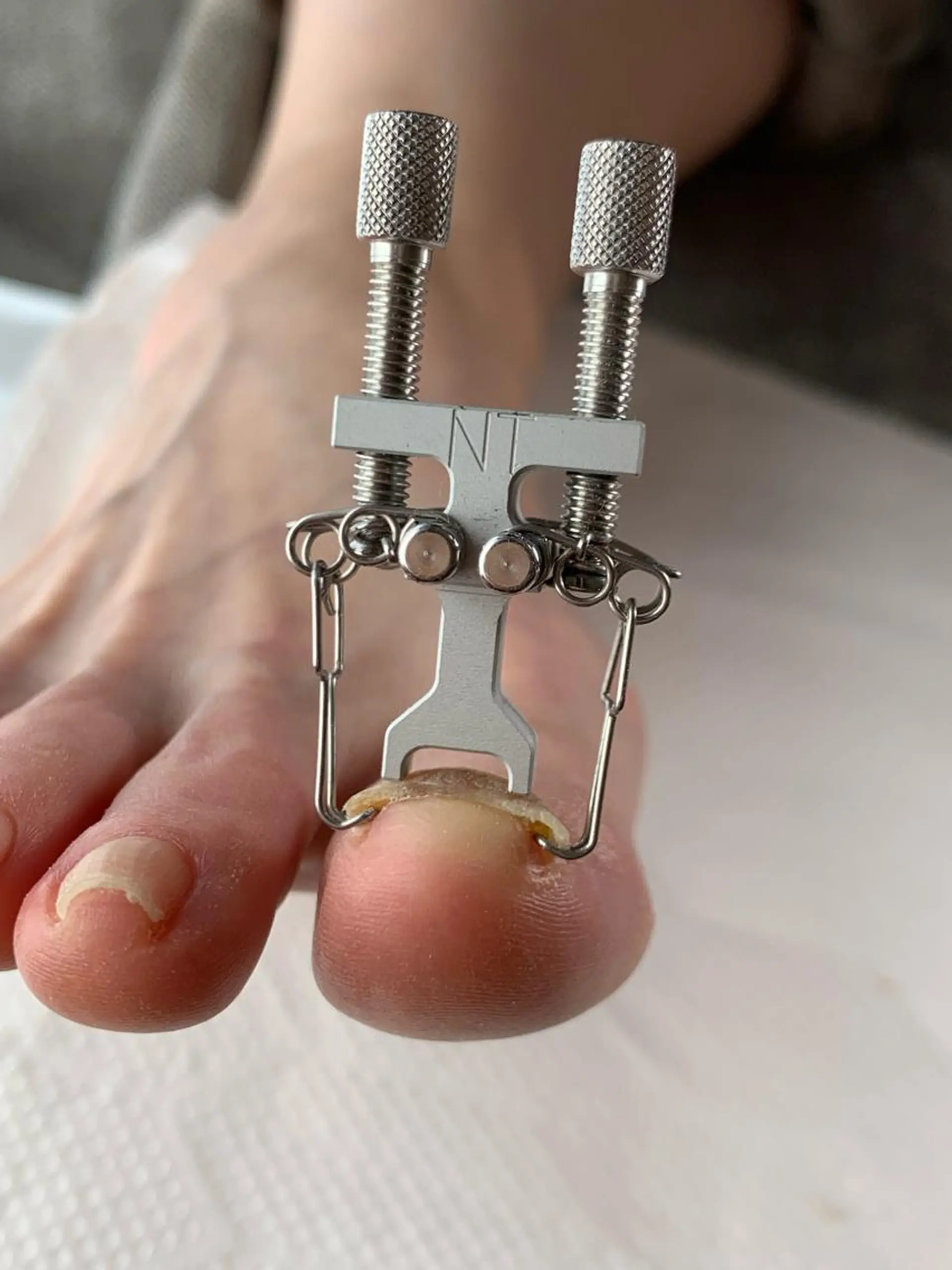 ネイル Takasaki Keikoのネイルデザイン