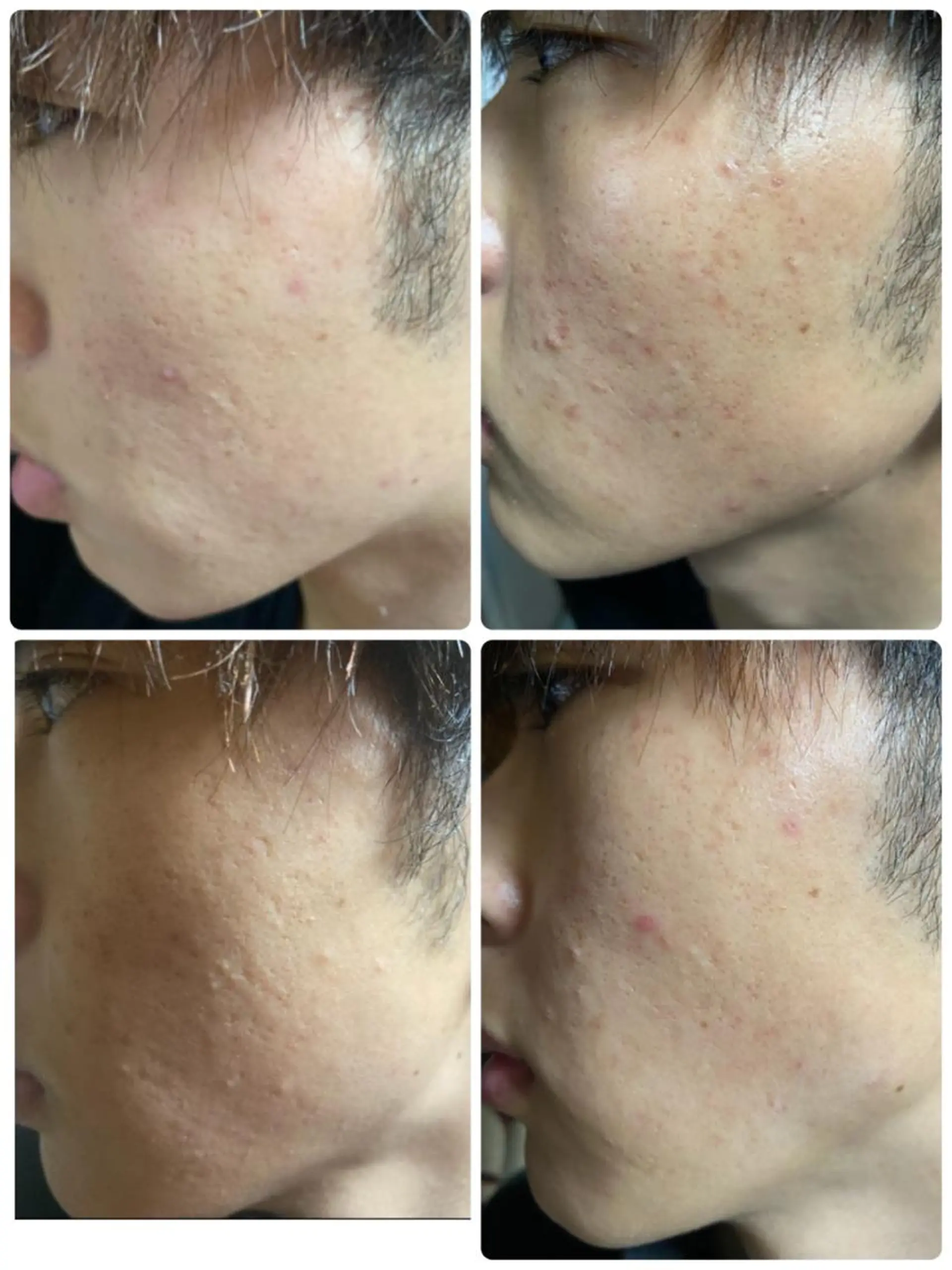 ARONA(アローナ)所属・ARONA ♡のエステ・リラクイメージ