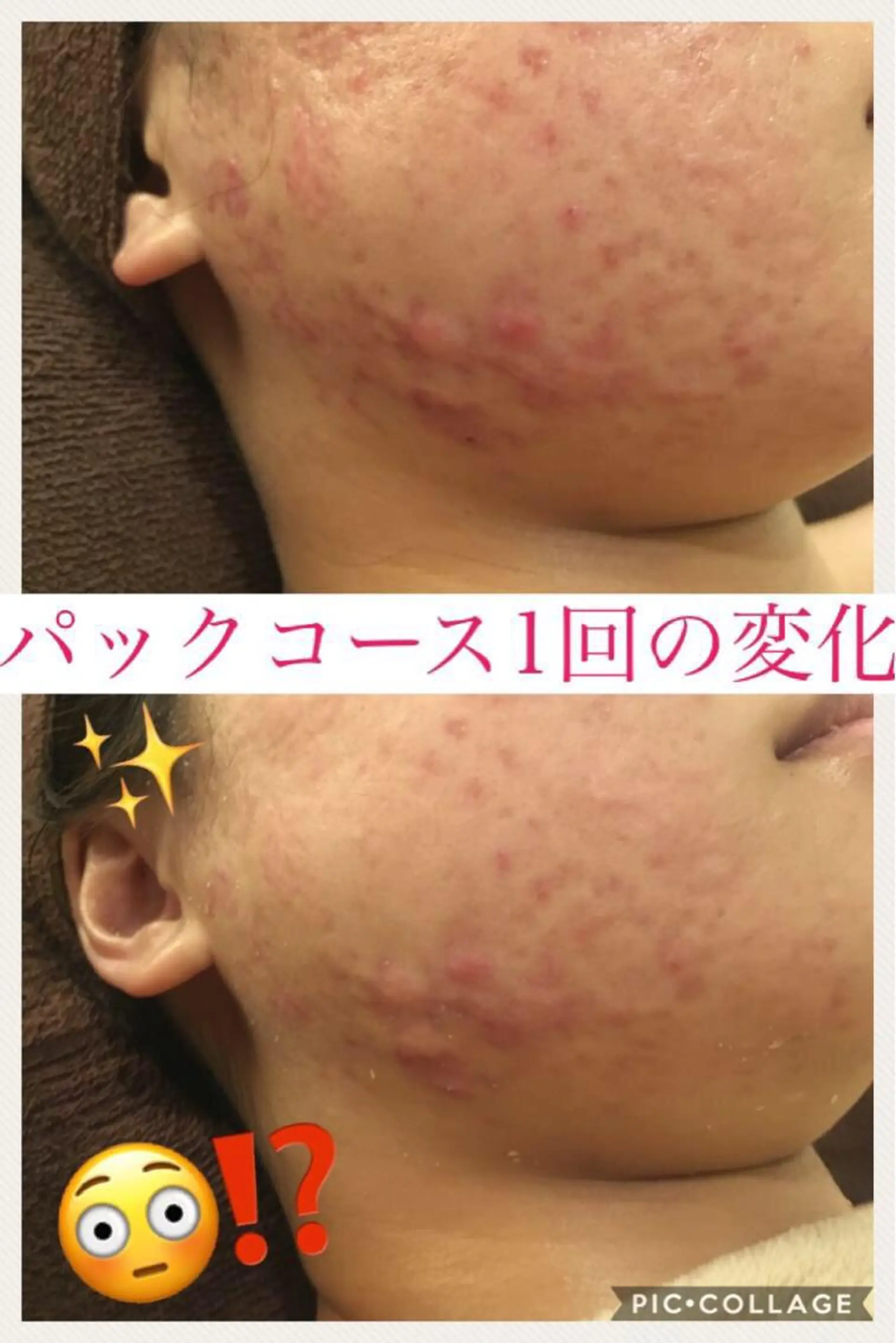 ショート カラー パーマ ヘアアレンジ メンズ キッズ ネイル マツエク・マツパ エステ リラク ニキビ・肌質改善専門 ♡人生が変わるサロンのエステ・リラクイメージ