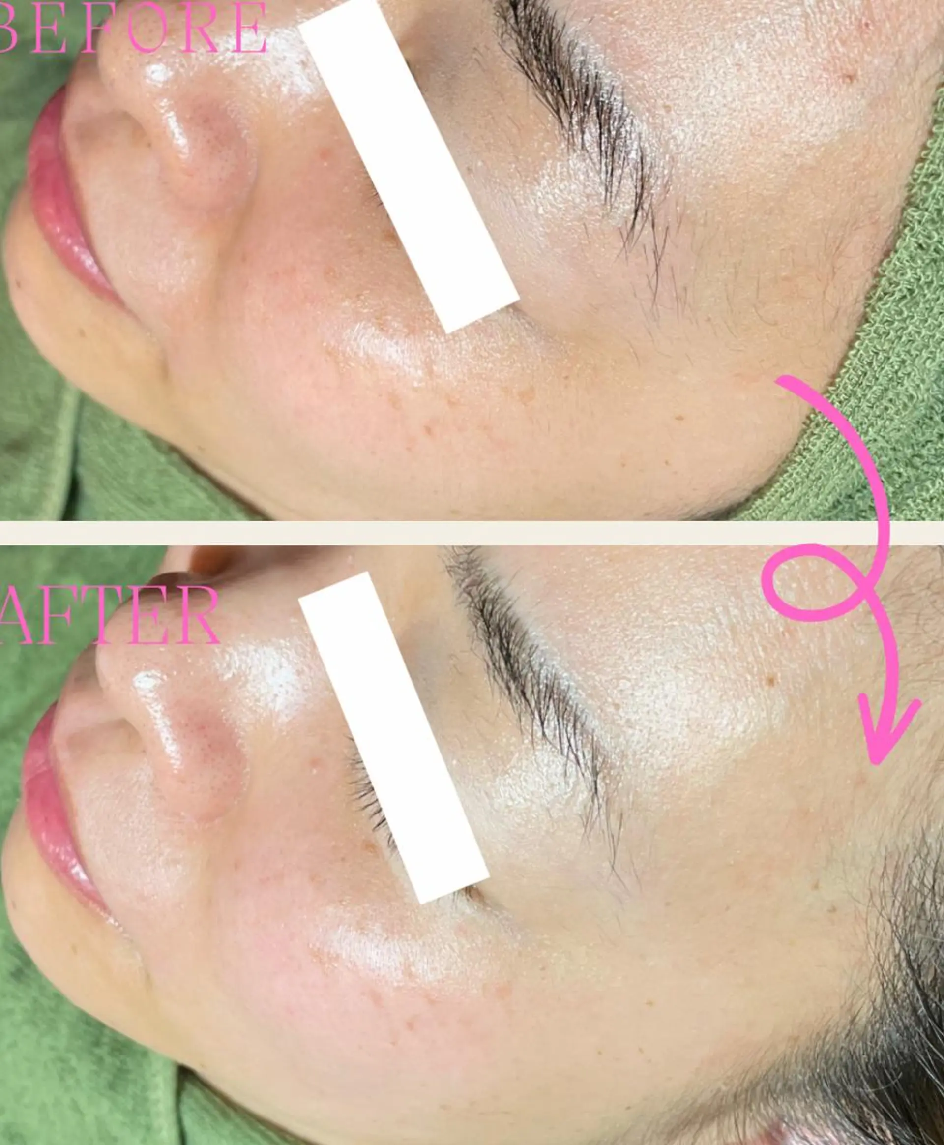 エステ リラク 痩身・フェイシャル/if  byOrabriller所属・if byOrab riller【ｲﾌ】のその他イメージ