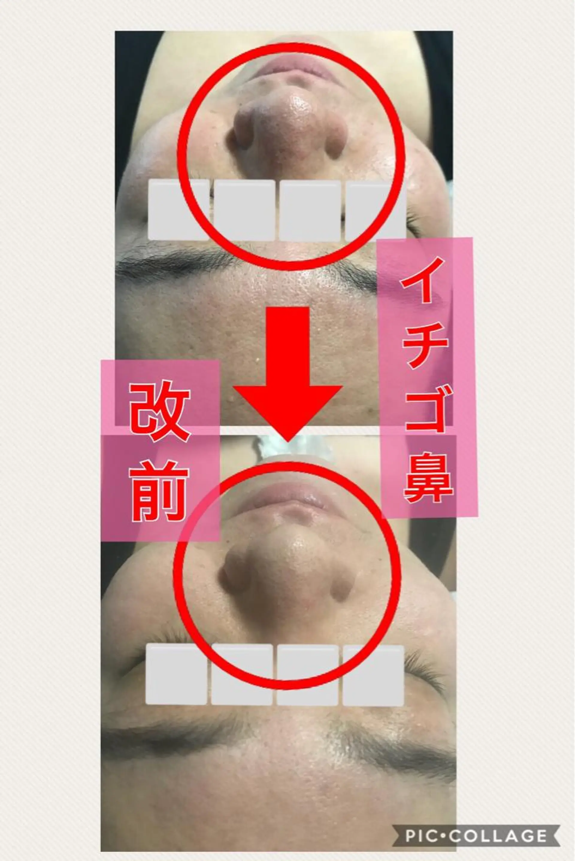 メンズ 四つ星サロン🎖 腸＆ニキビケアに特化のエステ・リラクイメージ