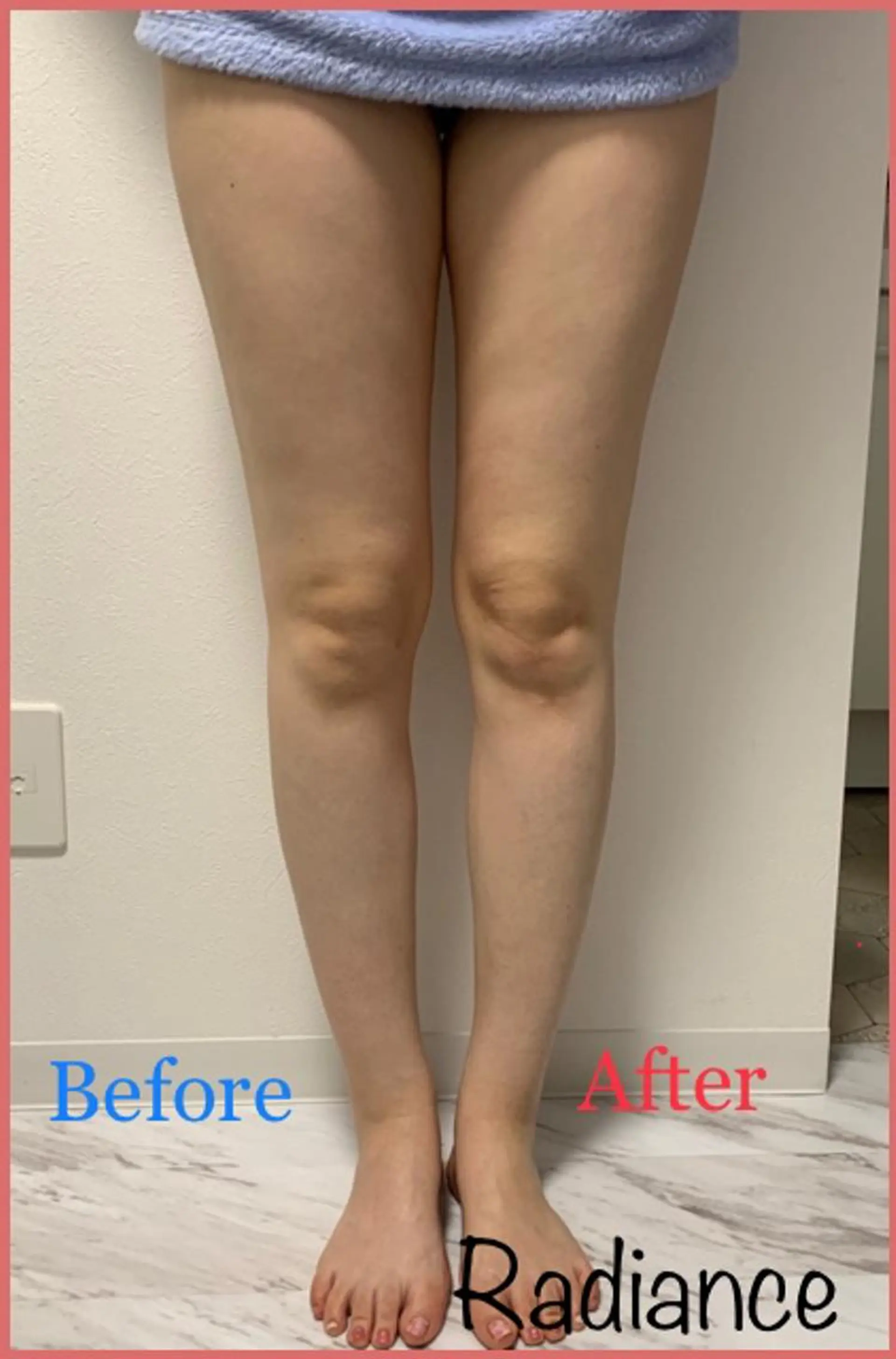 札幌ホワイトニング ラディアンス札幌駅店のその他イメージ