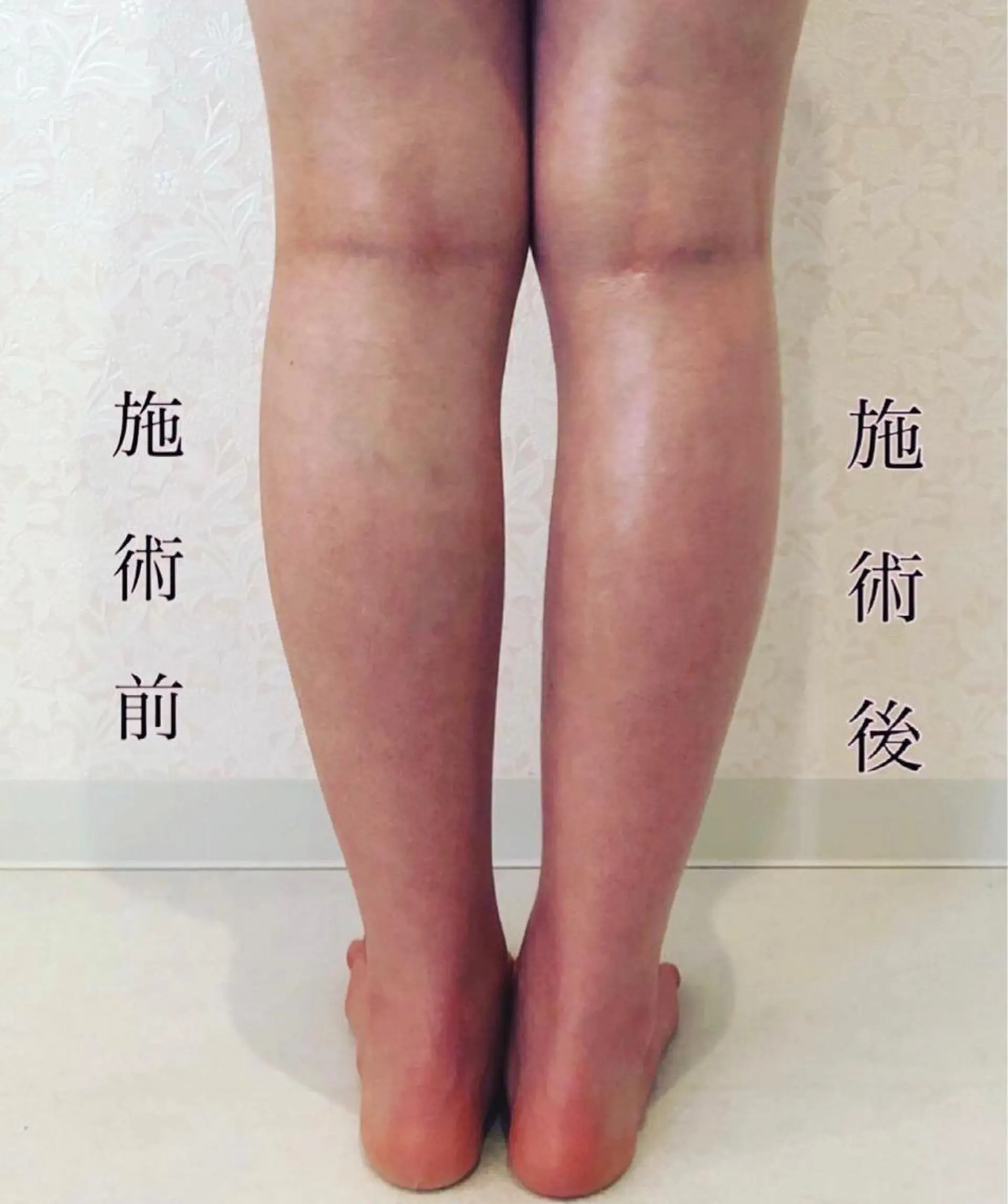 エステ リラク ❤︎MN❤︎ モンのエステ・リラクイメージ