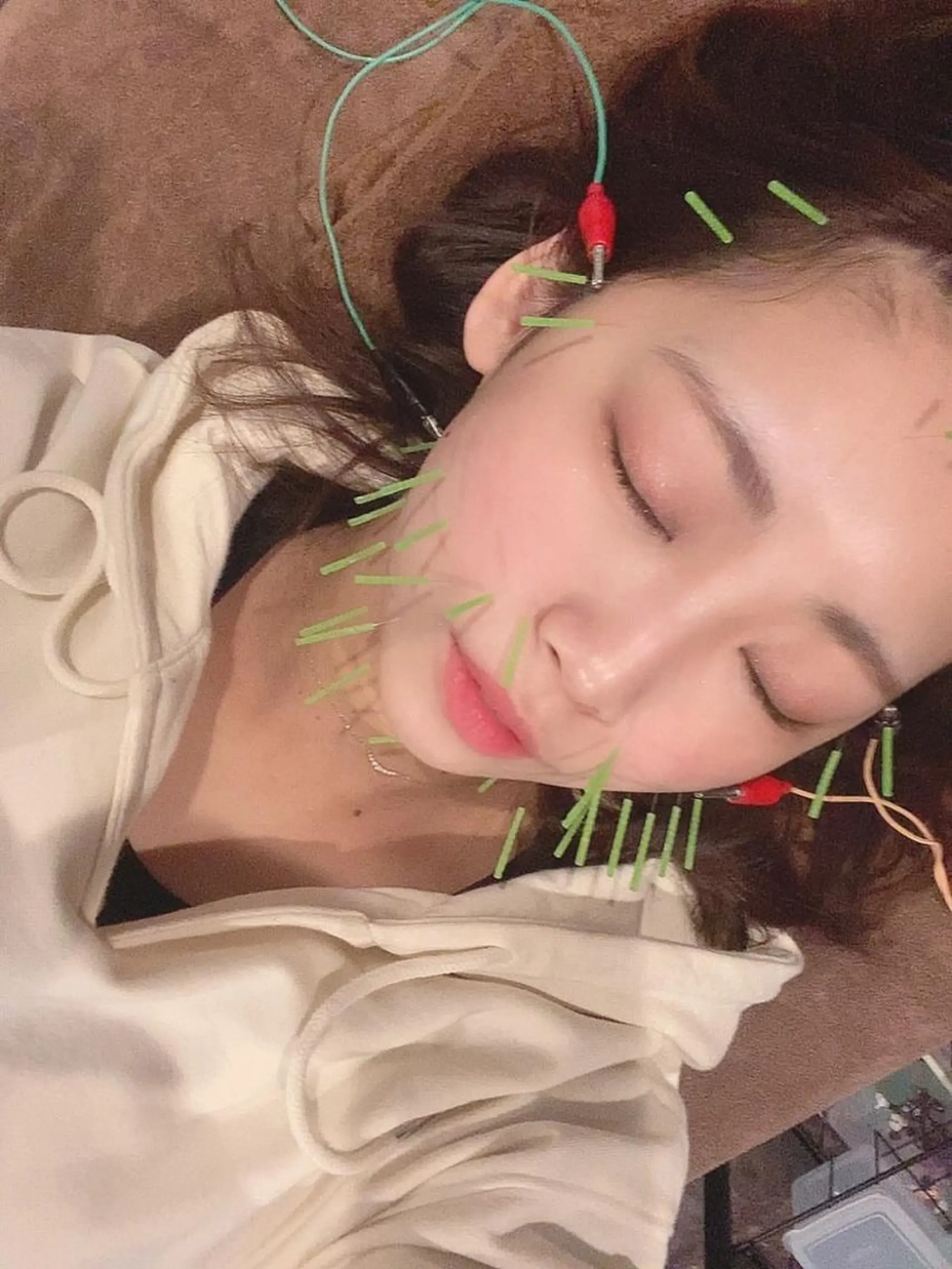 エステ リラク 美容鍼灸サロン LOMIHARIのエステ・リラクイメージ