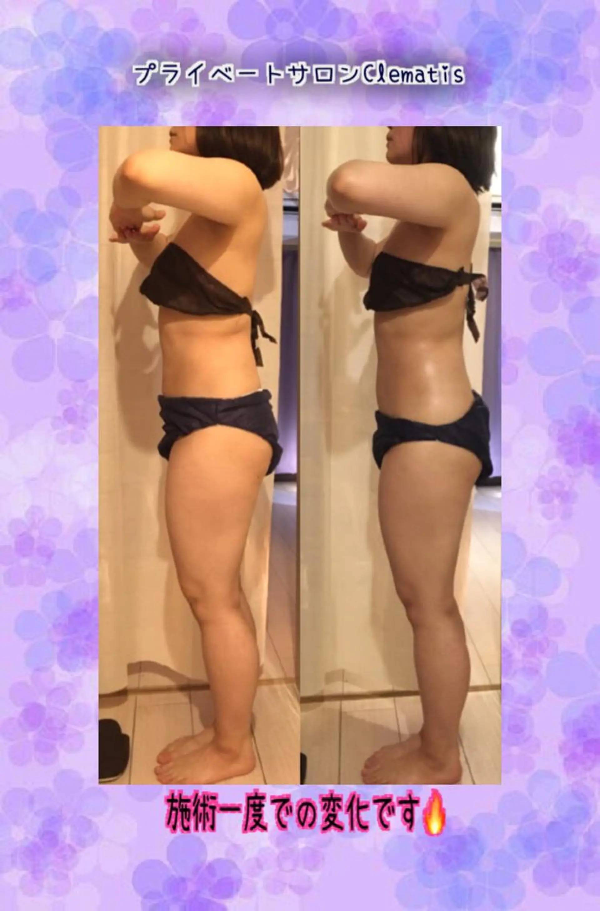 セミロング カラー パーマ ヘアアレンジ メンズ キッズ ネイル マツエク・マツパ 強圧オールハンド痩身&黄土よもぎ蒸しプライベートサロンClematis池袋所属・強圧オールハンド痩身 片野のエステ・リラクイメージ