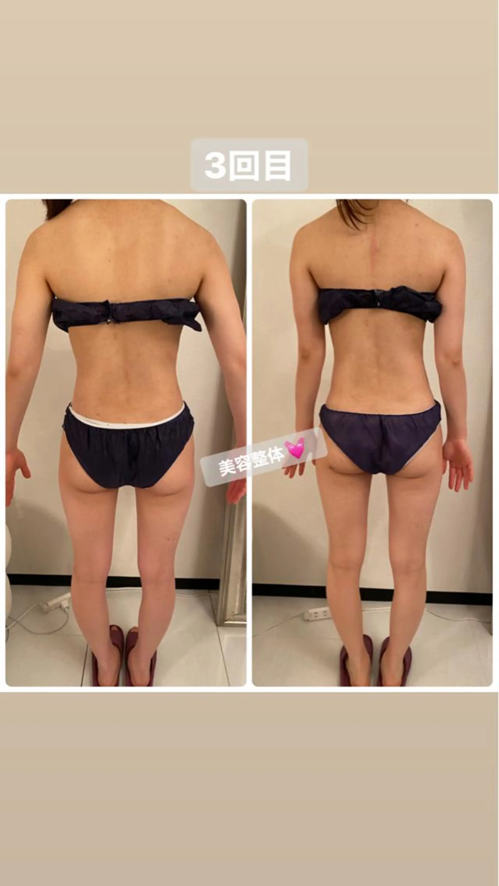 FLEUR大阪・整体 ・ハイフ・痩身・小顔のエステ・リラクイメージ