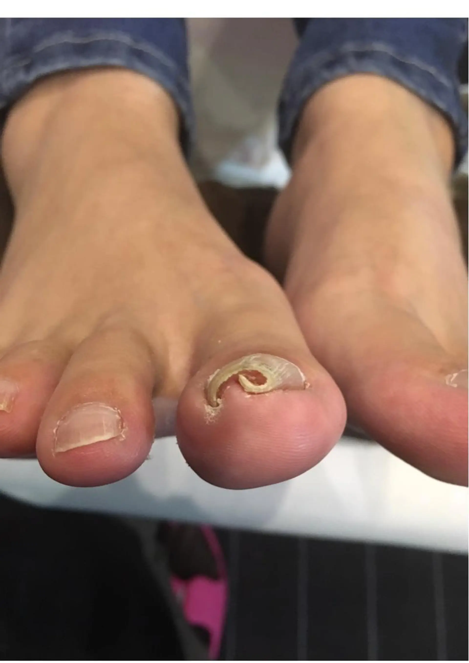 ネイル フットネイル 星 亜也加のネイルデザイン