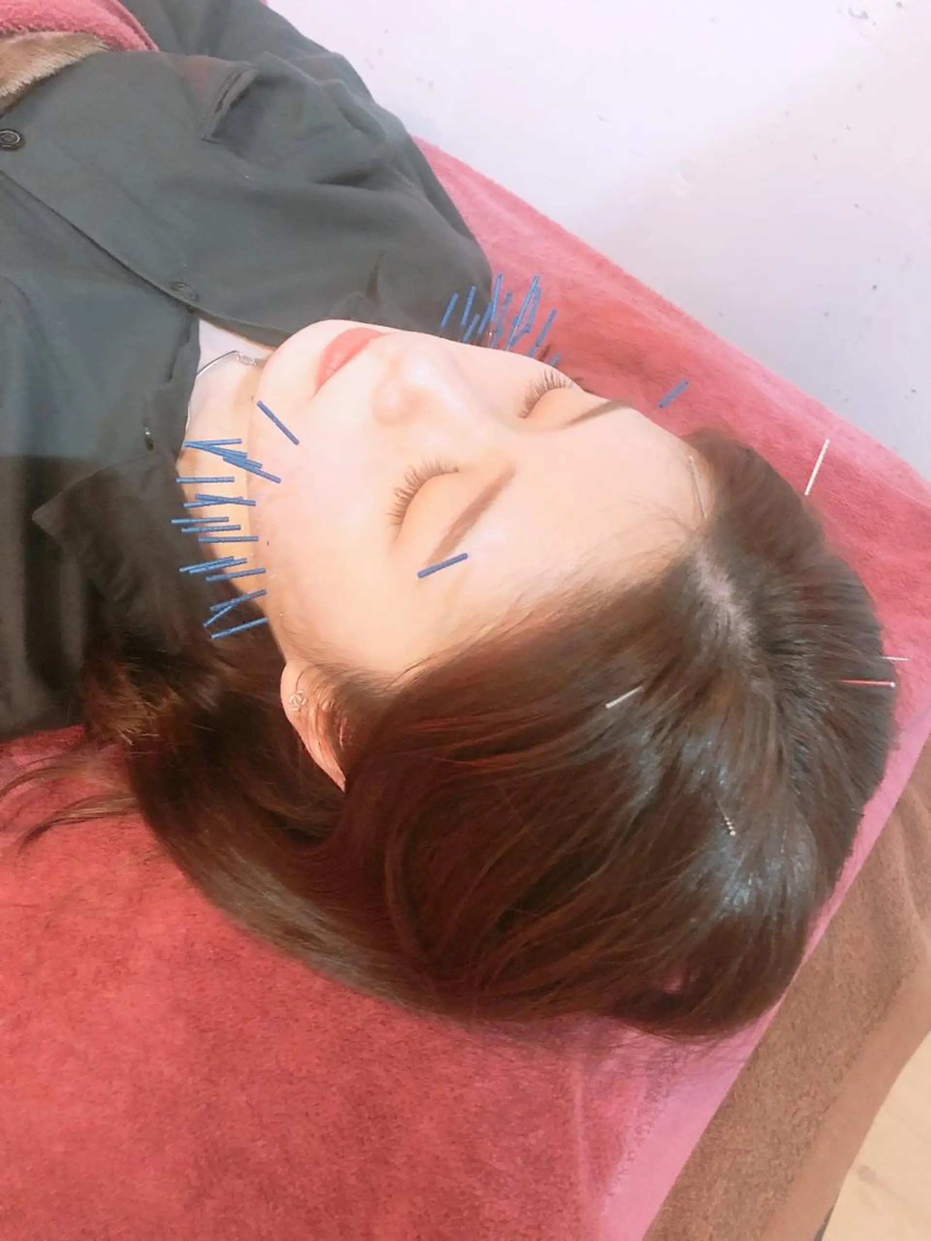 美容鍼灸女性専用 りんご鍼灸治療院のその他イメージ