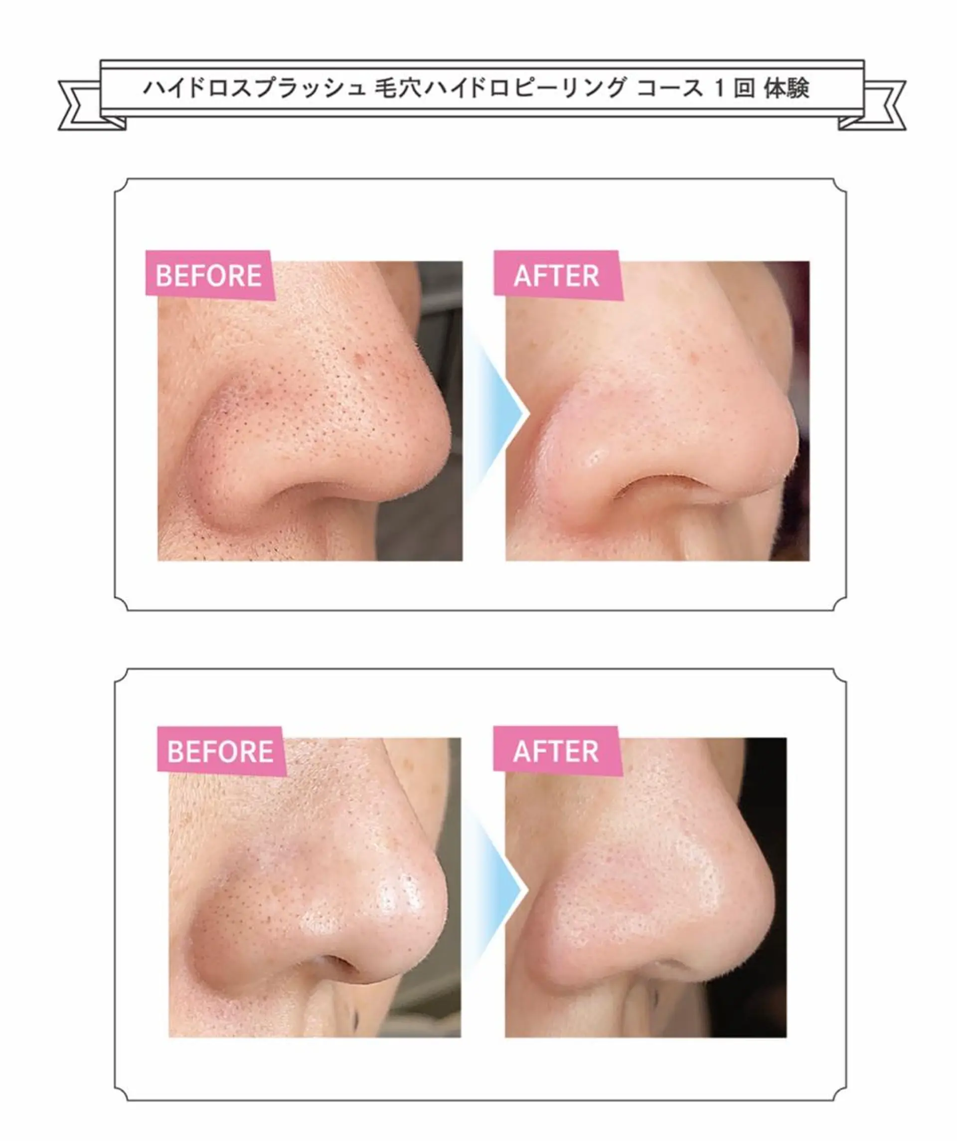 ショート エステ LUCIALL  ルシアル所属・児玉 愛由美のエステ・リラクイメージ