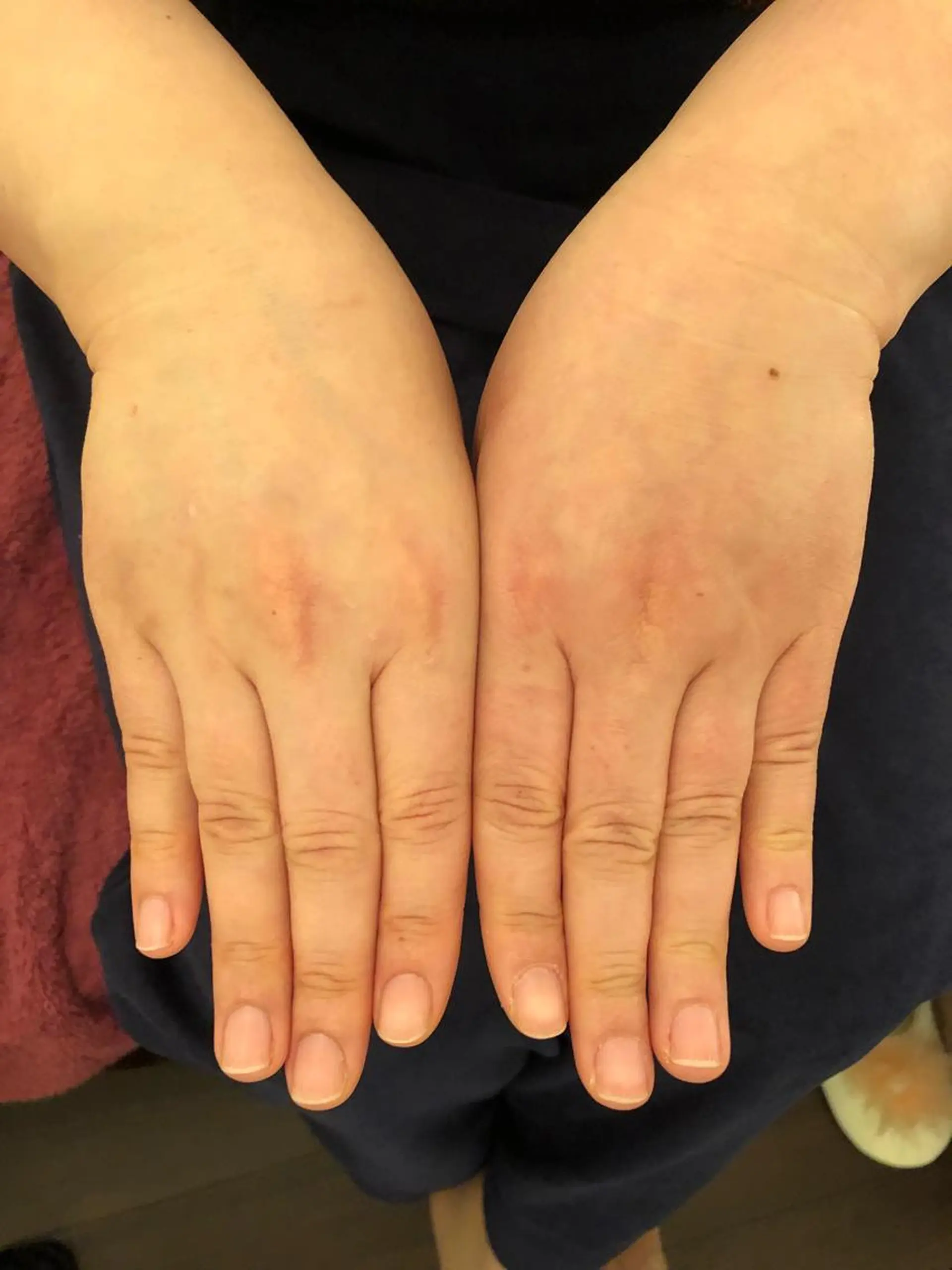 FLEUR大阪・整体 ・ハイフ・痩身・小顔のエステ・リラクイメージ