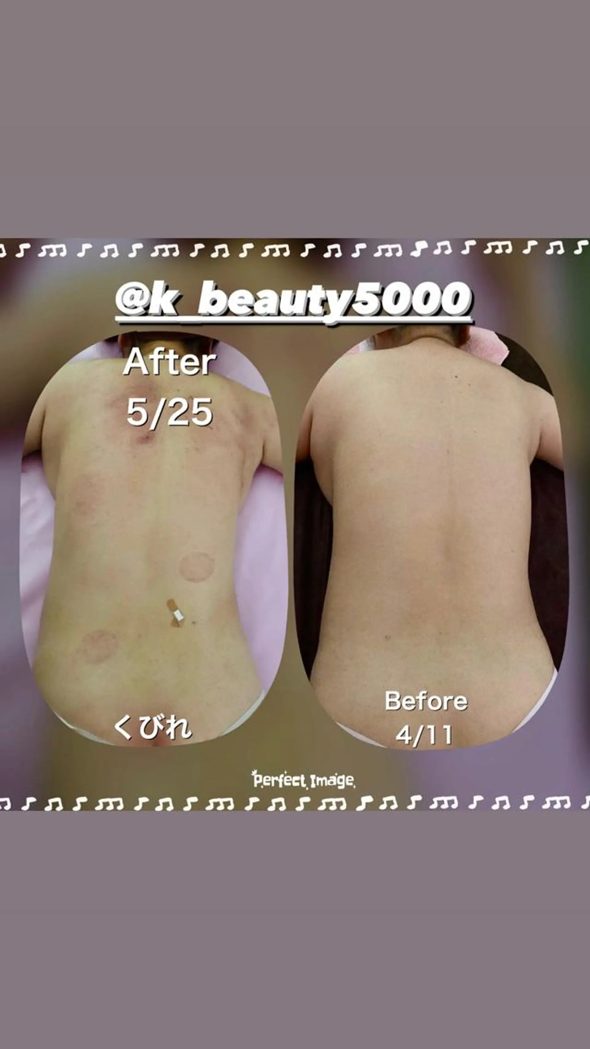 【ハイパーナイフ痩身&小顔コルギ&ハーブピーリング】K-Beauty　東新宿所属・kーbeauty痩身 フェイシャルのエステ・リラクイメージ