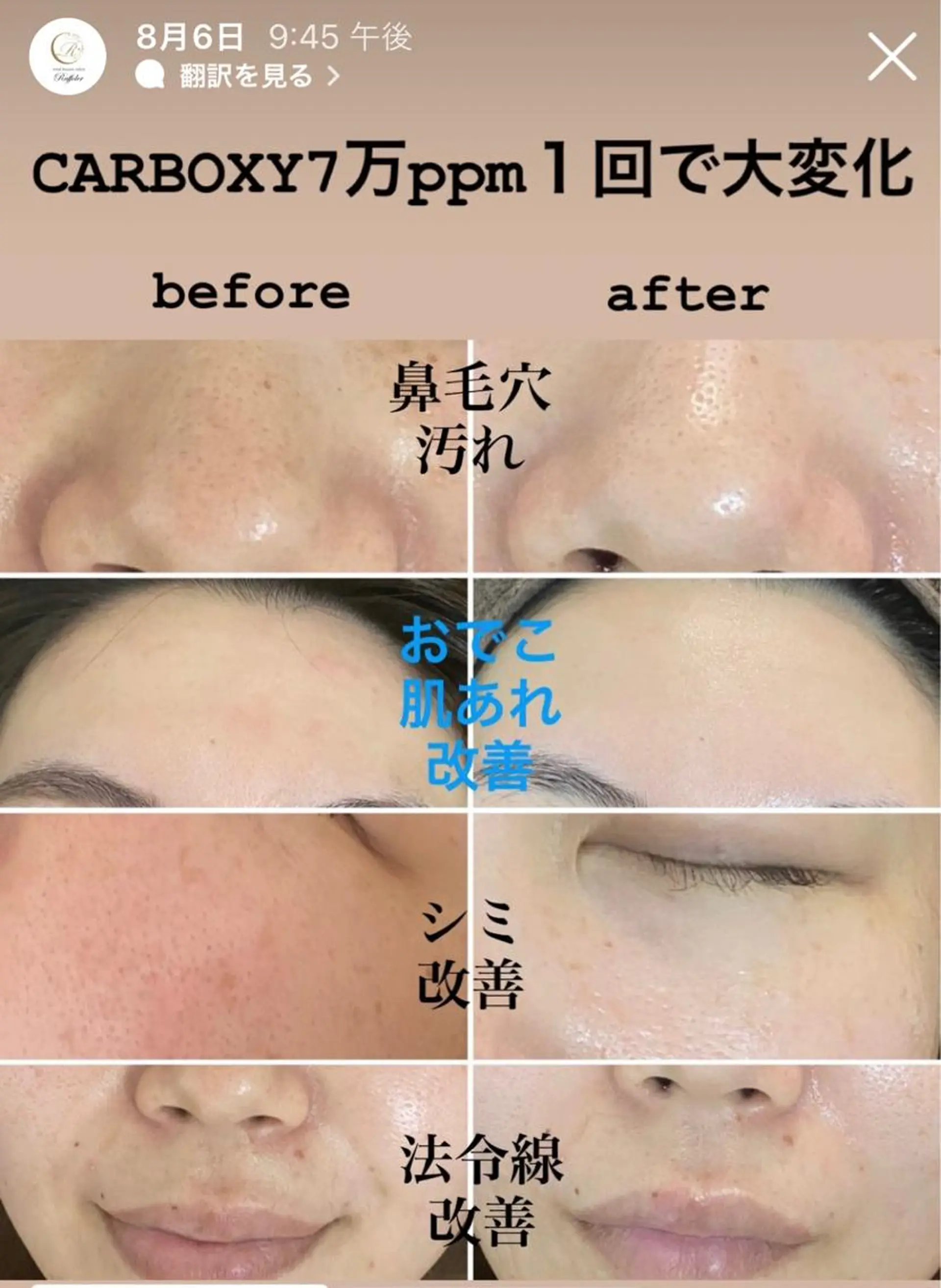 エステ total beauty salon Raffoler所属・Raffoler りさのエステ・リラクイメージ