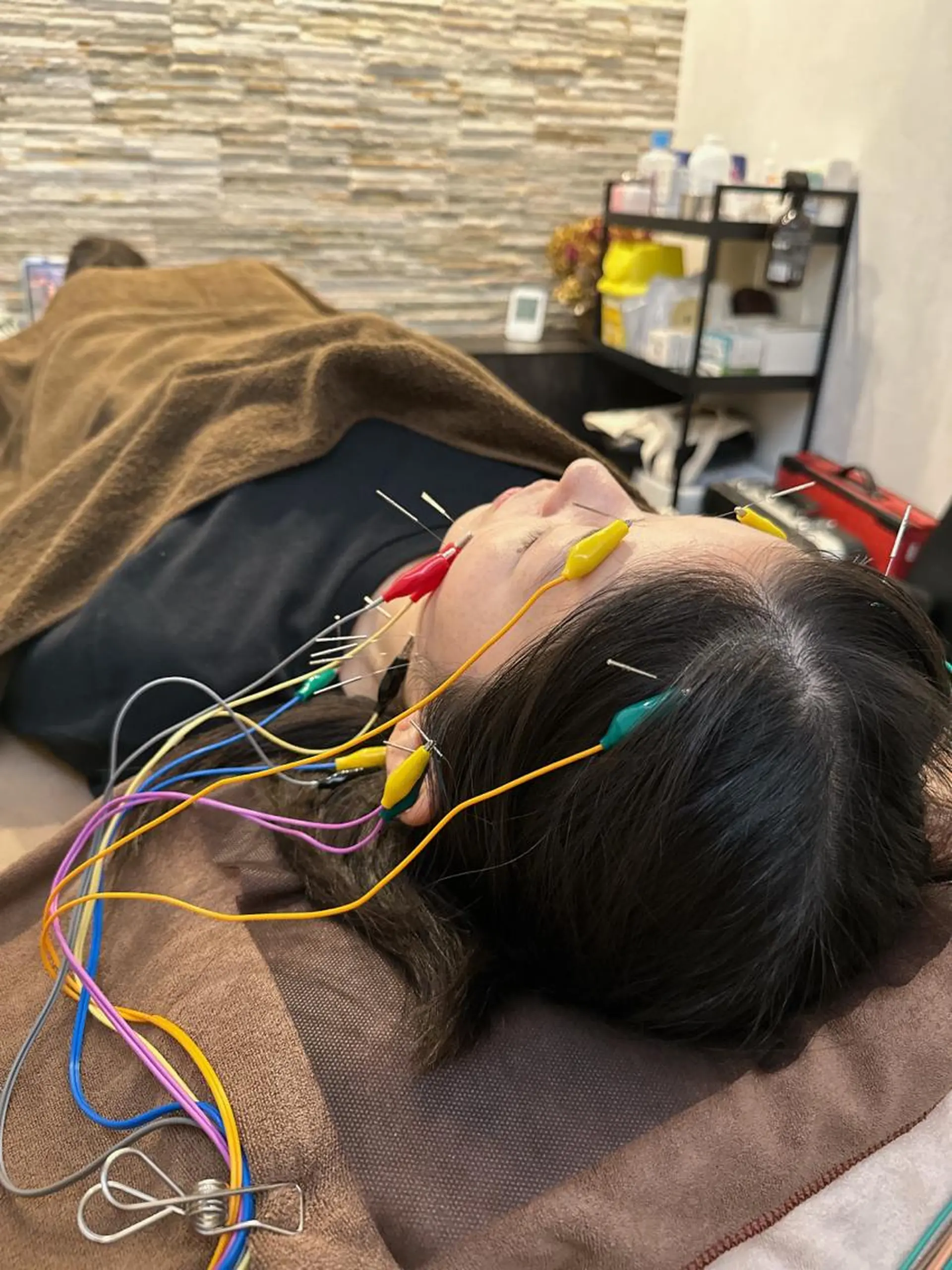 その他 美容鍼灸整体サロンBeauJu所属・小顔矯/美容鍼/鍼灸 BeauJuのその他イメージ