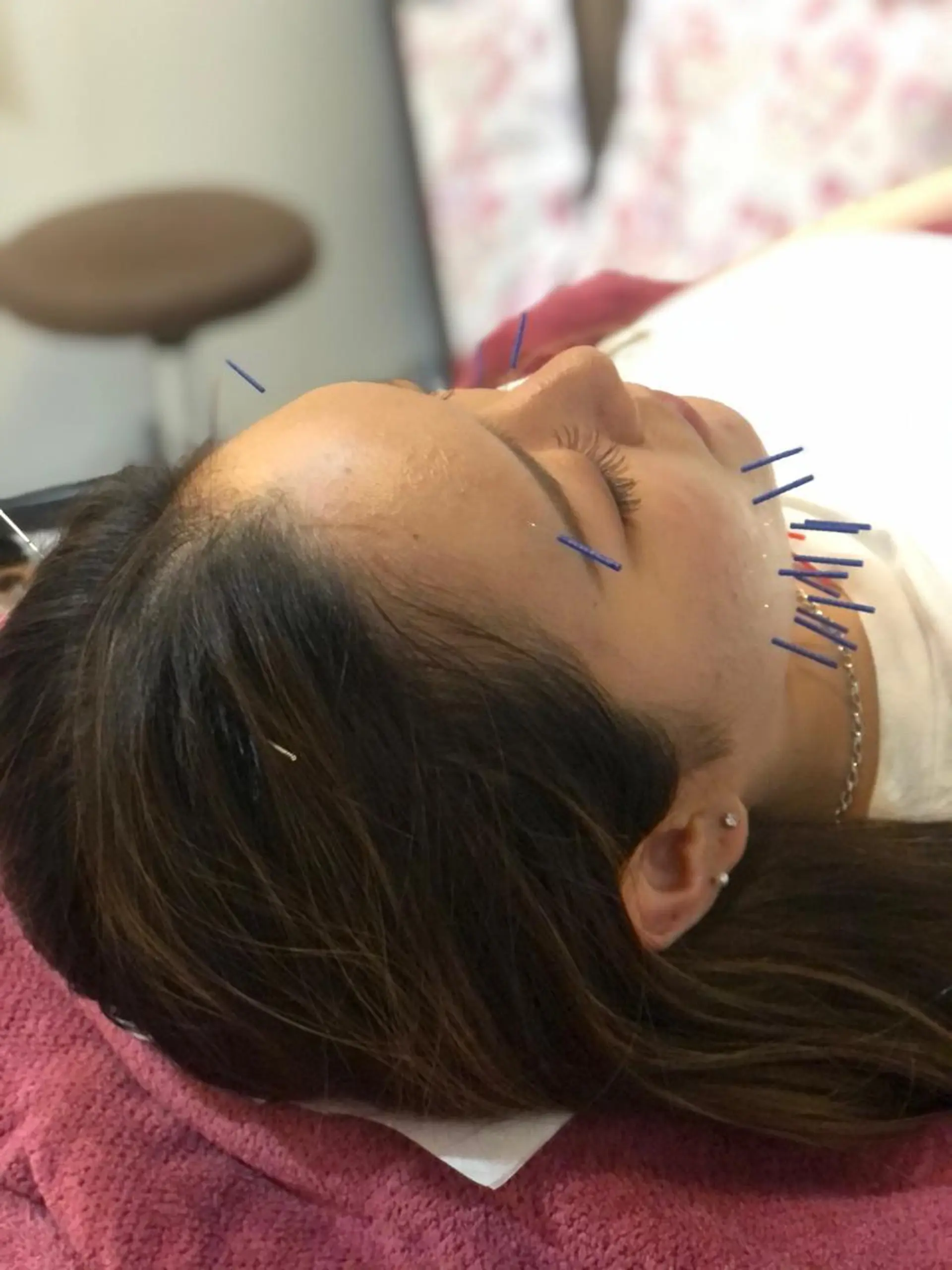 美容鍼灸女性専用 りんご鍼灸治療院のその他イメージ