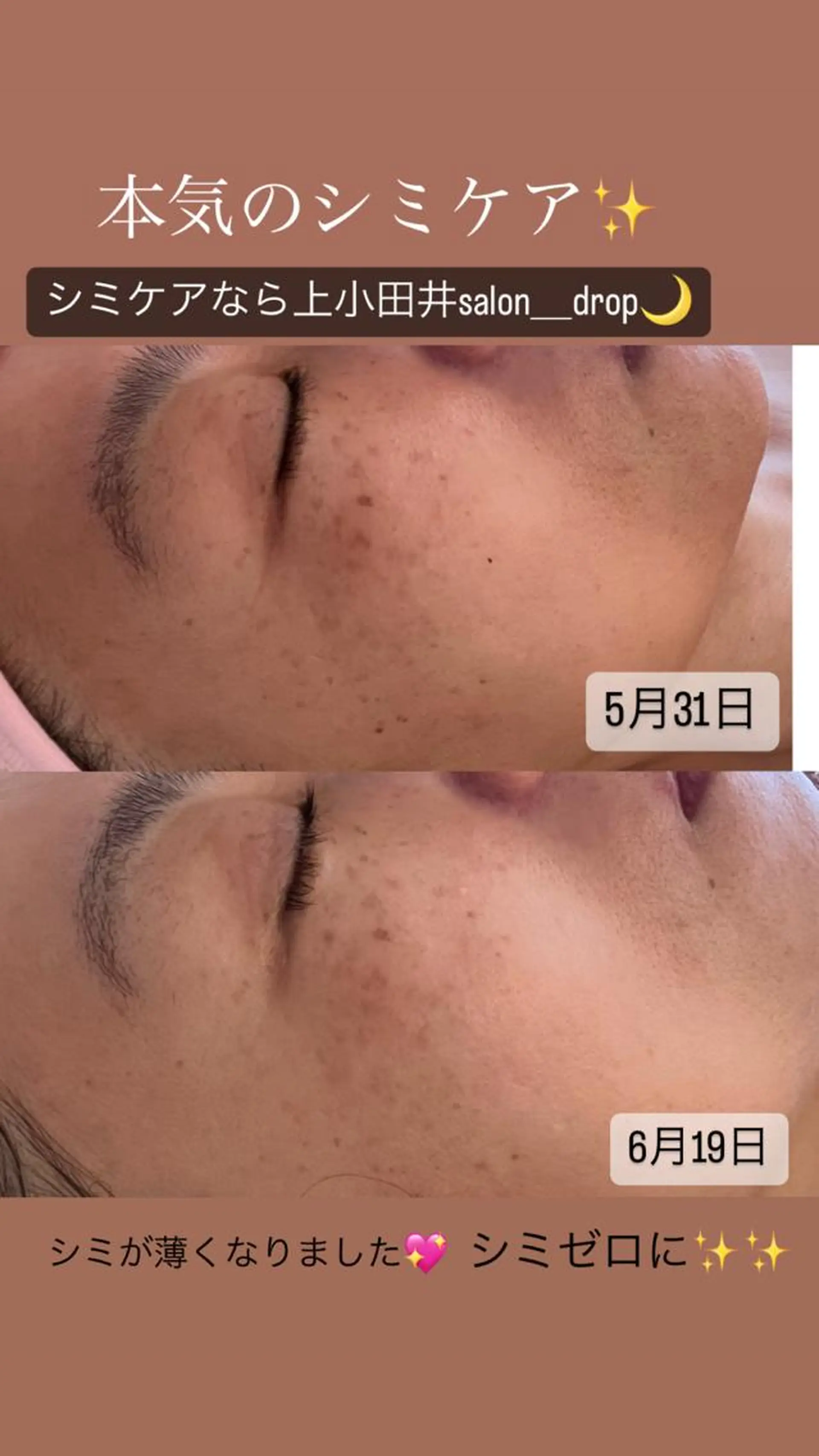 salon＿drop所属・salon dropのエステ・リラクイメージ