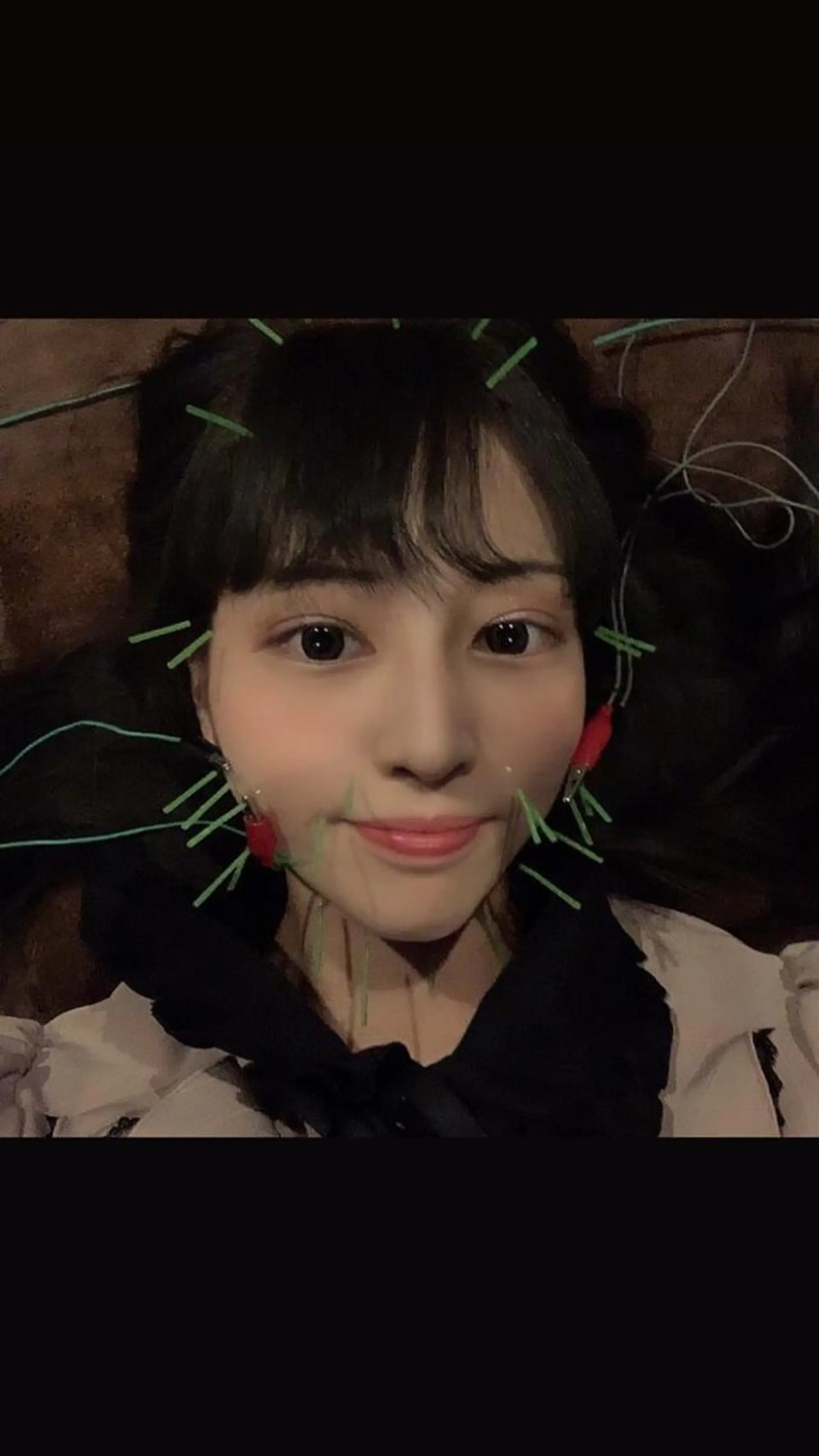 エステ リラク 美容鍼灸サロン LOMIHARIのエステ・リラクイメージ