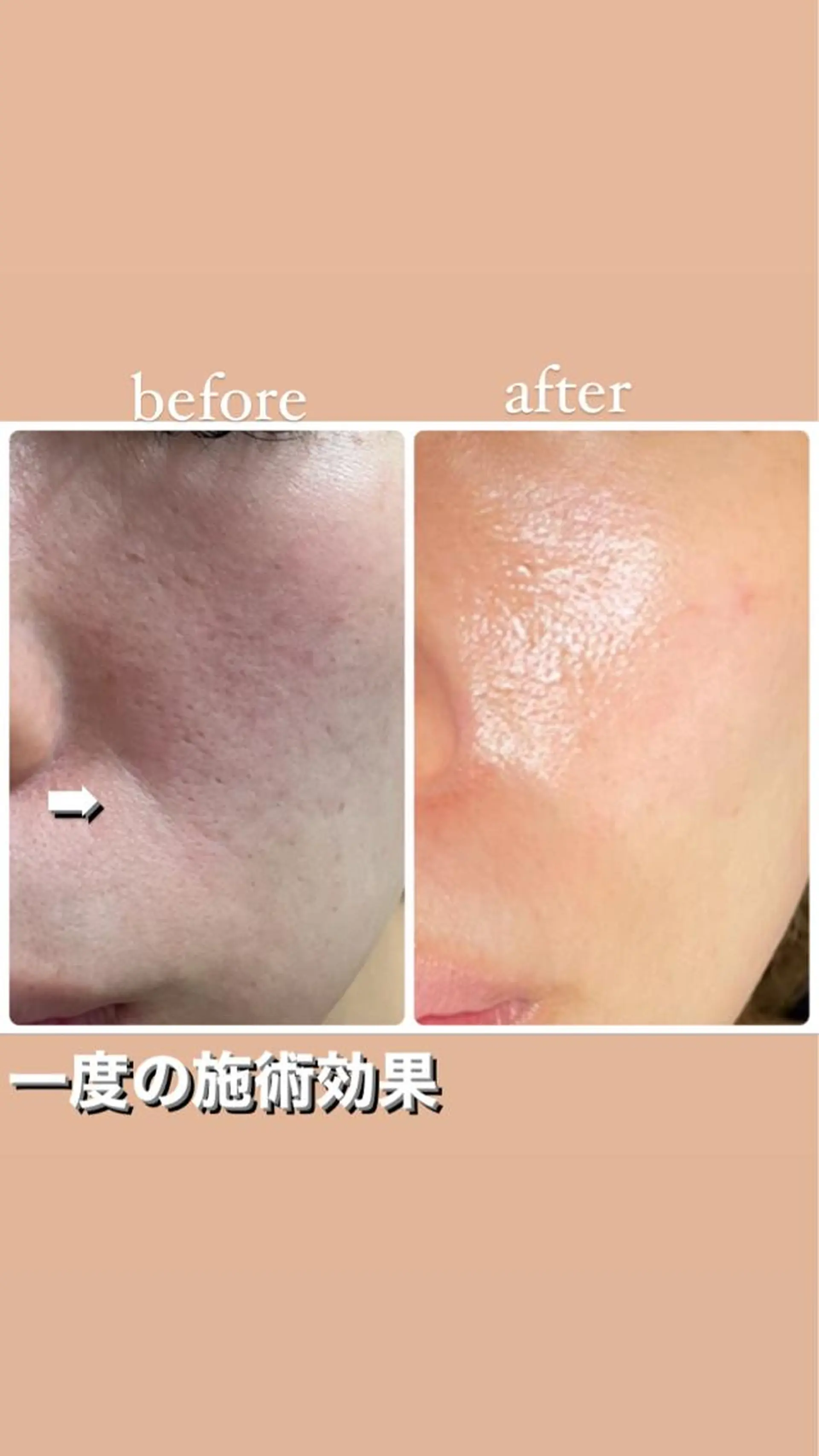セミロング カラー パーマ ヘアアレンジ メンズ キッズ ネイル マツエク・マツパ アイブロウ エステ リラク ビューティーサロンRavi所属・ビューティーサロン Raviのエステ・リラクイメージ