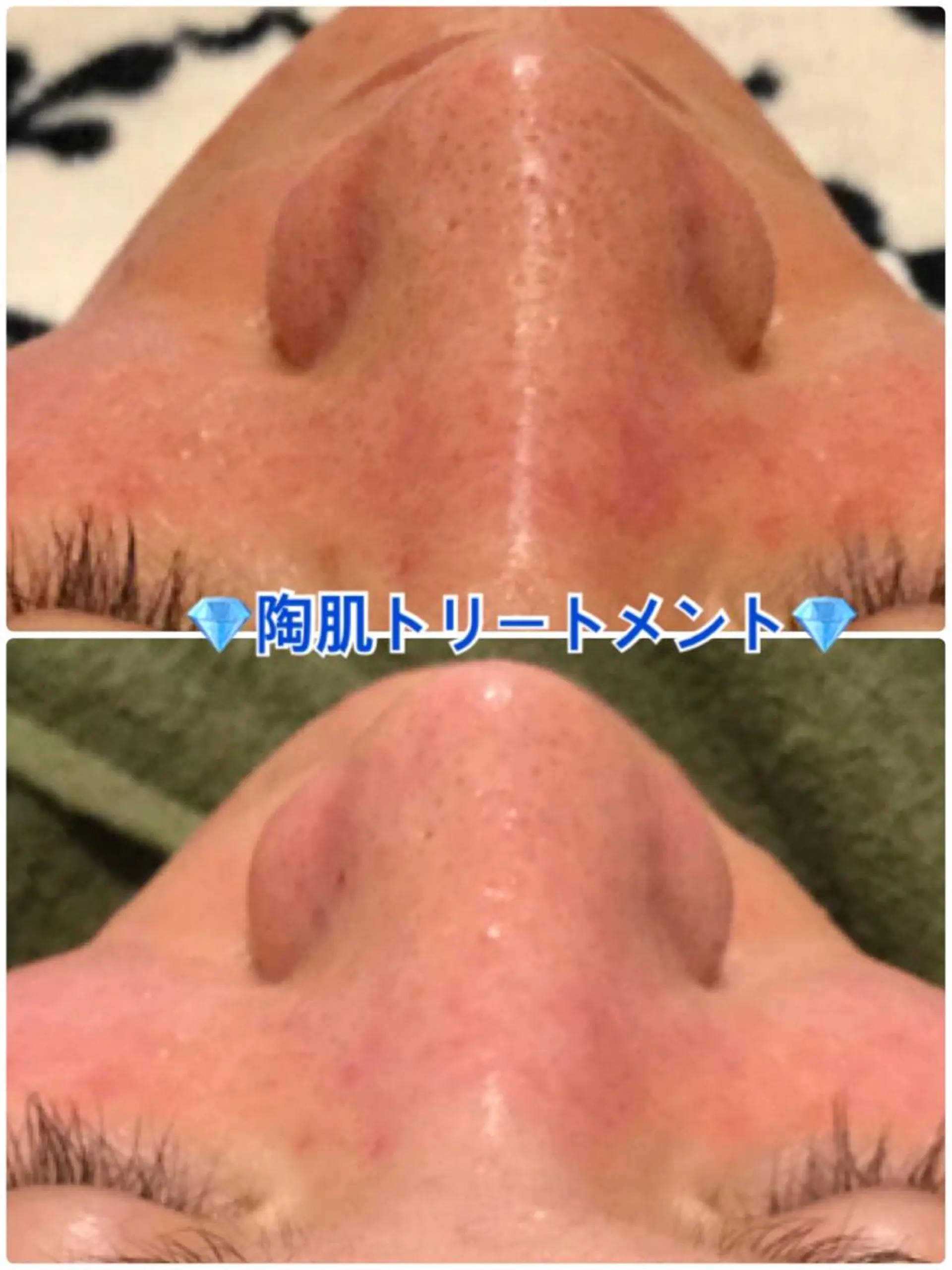 エステ 【リベルハーブピーリング認定店】敏感肌・美白脱毛専門店Dione立川店所属・Dione 立川店のエステ・リラクイメージ