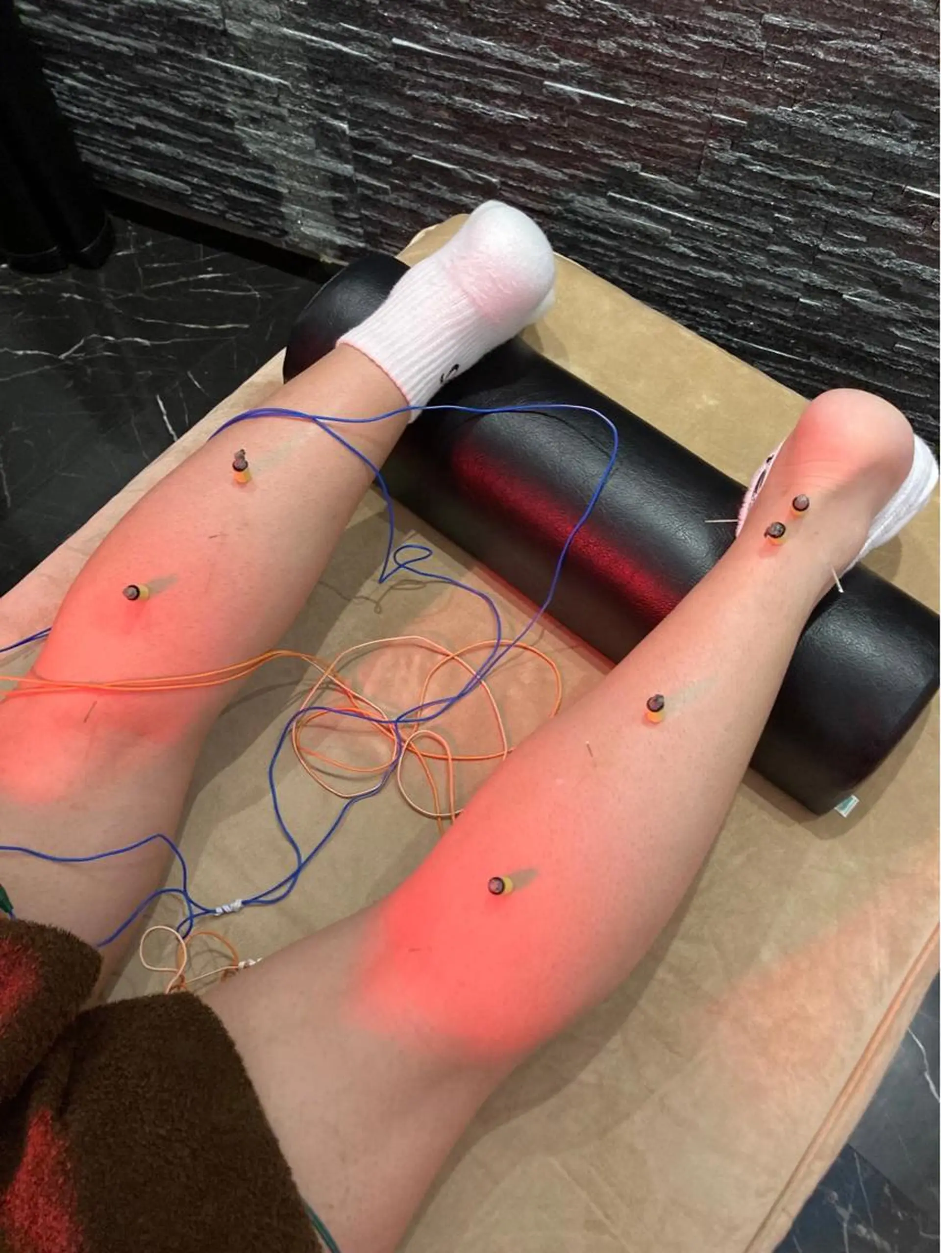 その他 美容鍼灸整体サロンBeauJu所属・小顔矯/美容鍼/鍼灸 BeauJuのその他イメージ